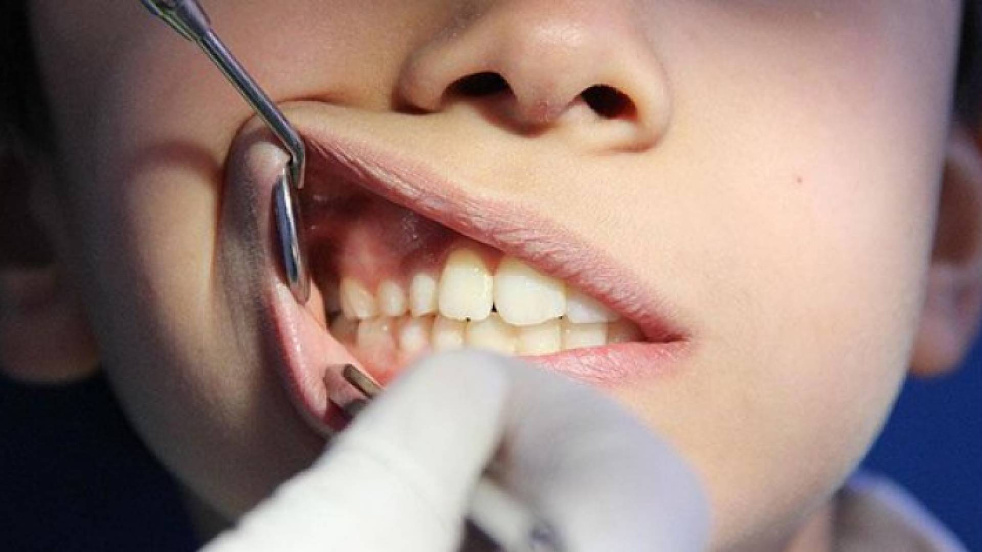 الصورة تعبيرية