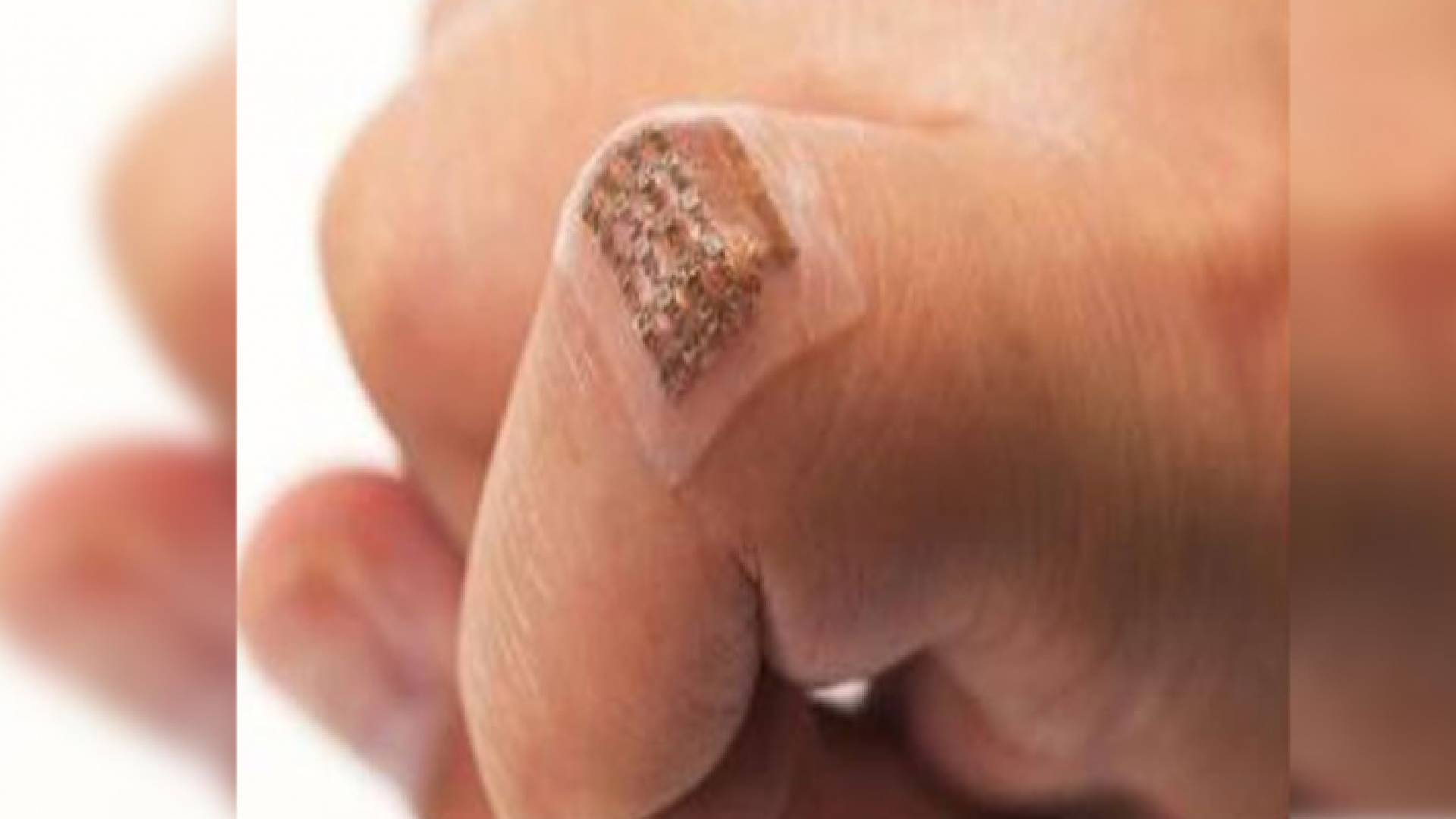 الصورة تعبيرية