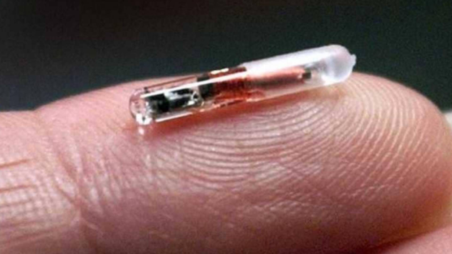 تثبت الشريحة بين الإبهام والسبابة