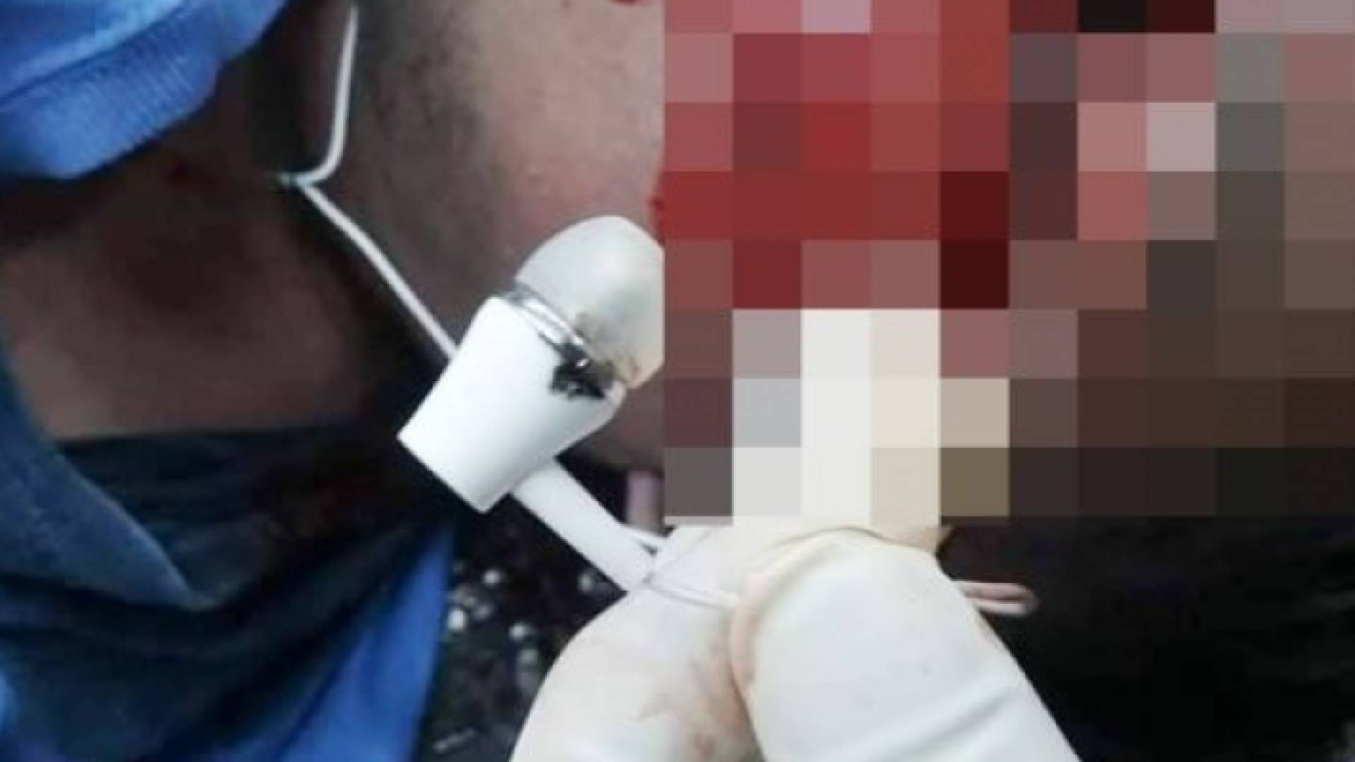 السامعة التي كان يستخدمها الطفل الماليزي