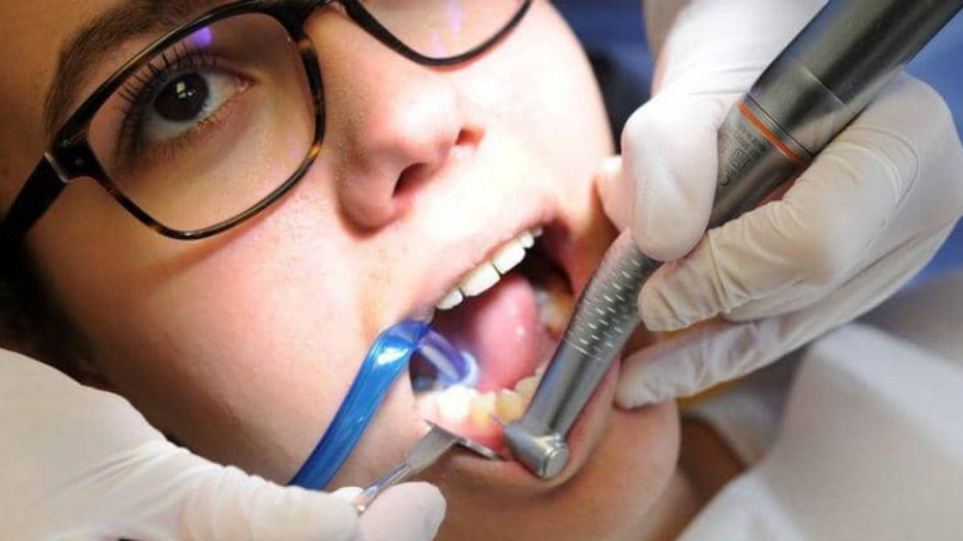 يتجاهل كثيرون أعراضا تدل على وجود مشكلة في أسنانهم