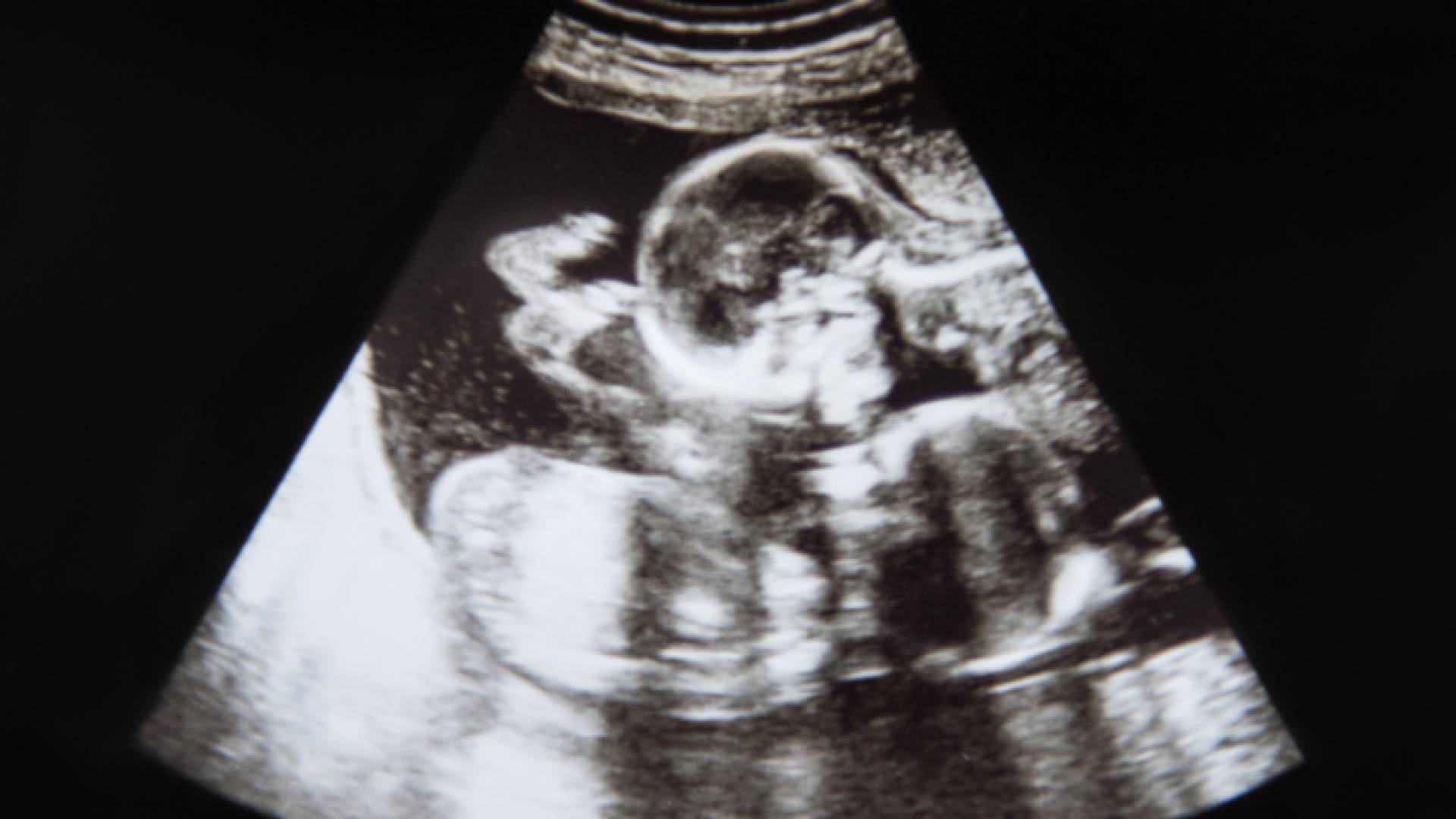 صورة من الفيديو