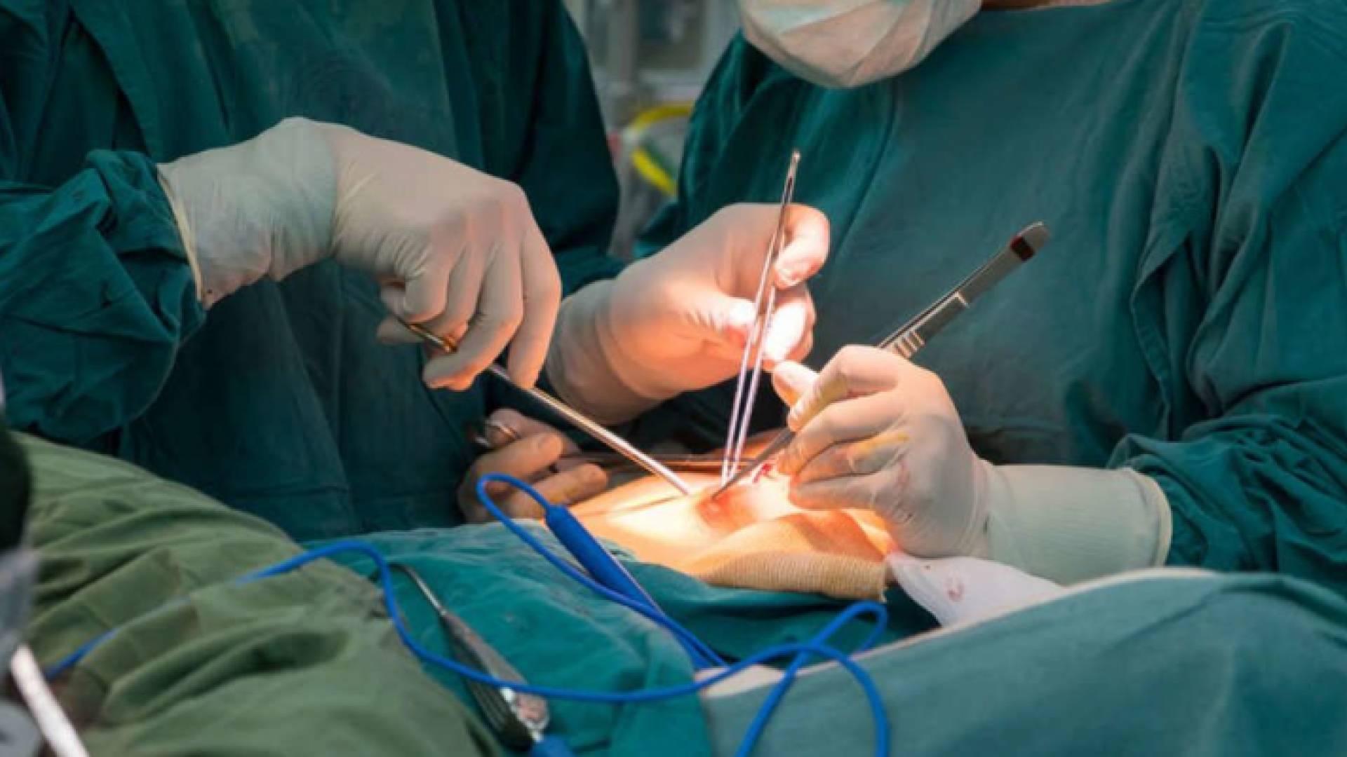 عملية جراحية - ارشيفية