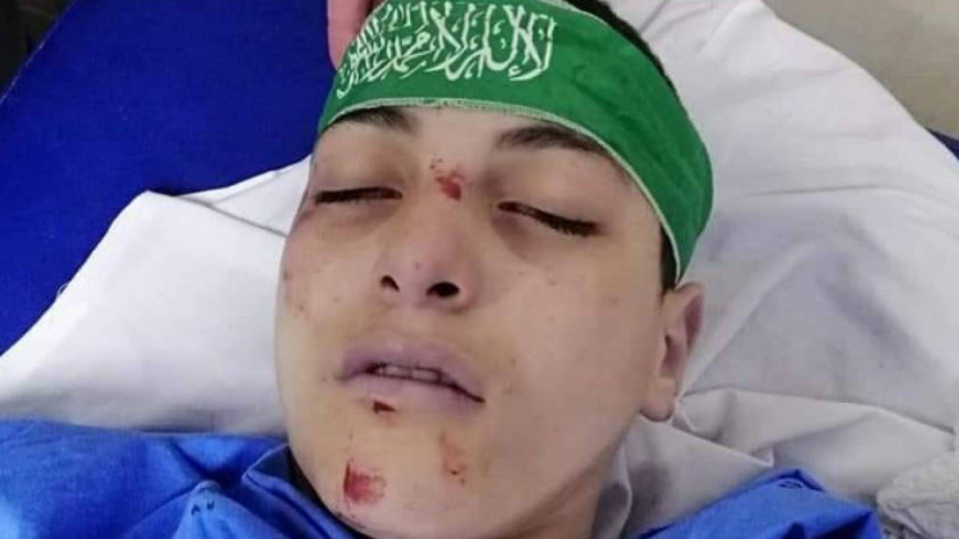 الطفل الفلسطيني عبد الله غيث "15عاما