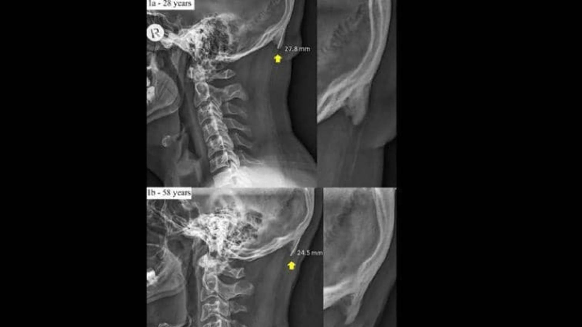 الدراسة أجريت في أستراليا