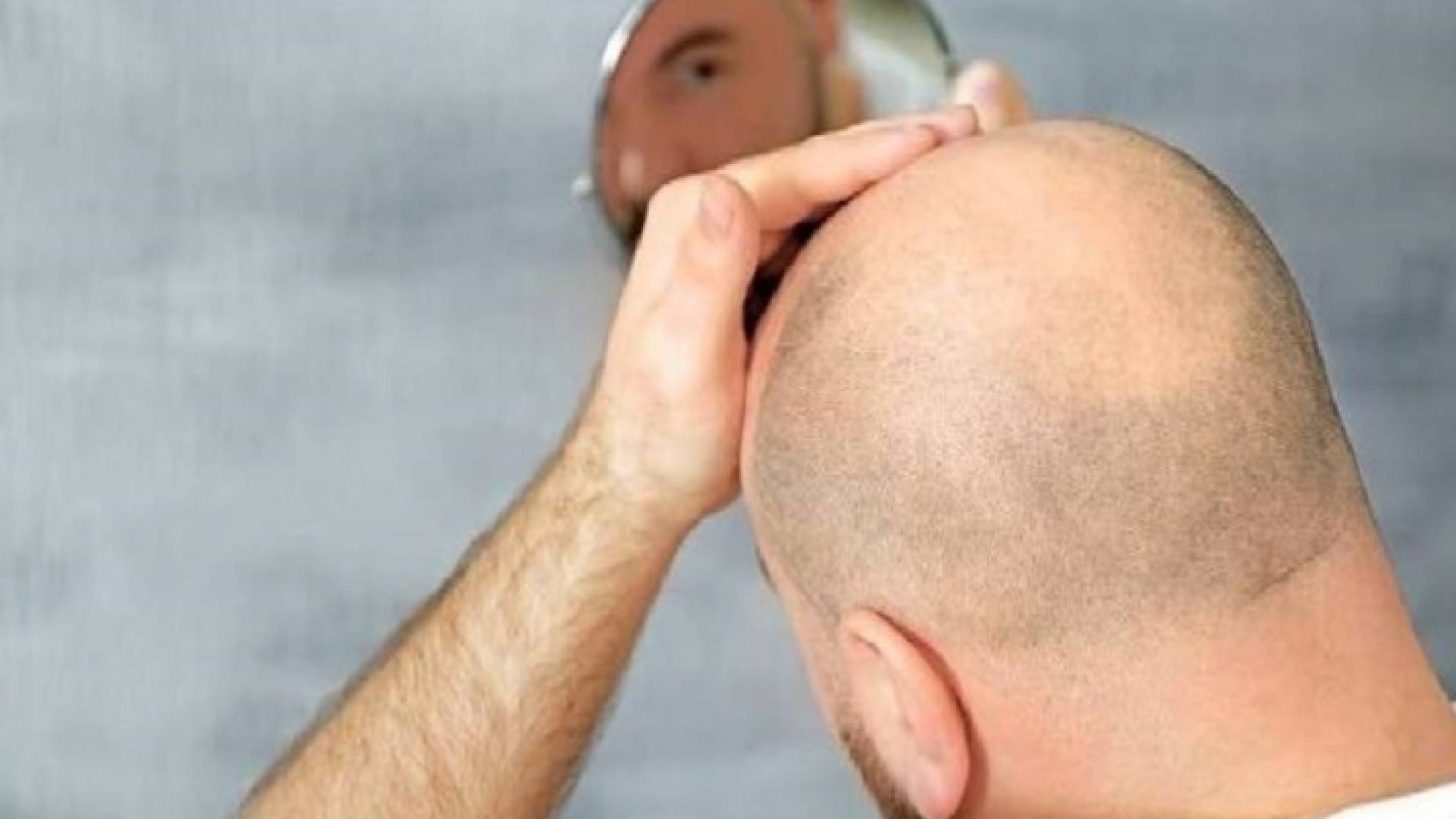 الصورة تعبيرية