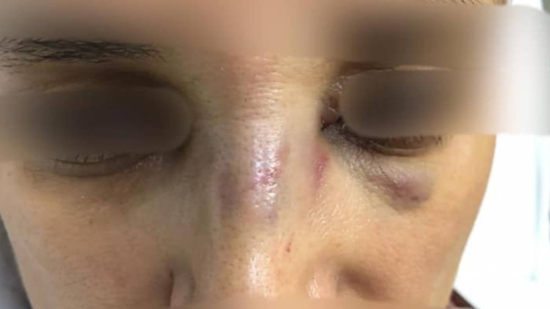 صورة الزوجة المعنفة من قبل زوجها كما نشرتها الناشطة