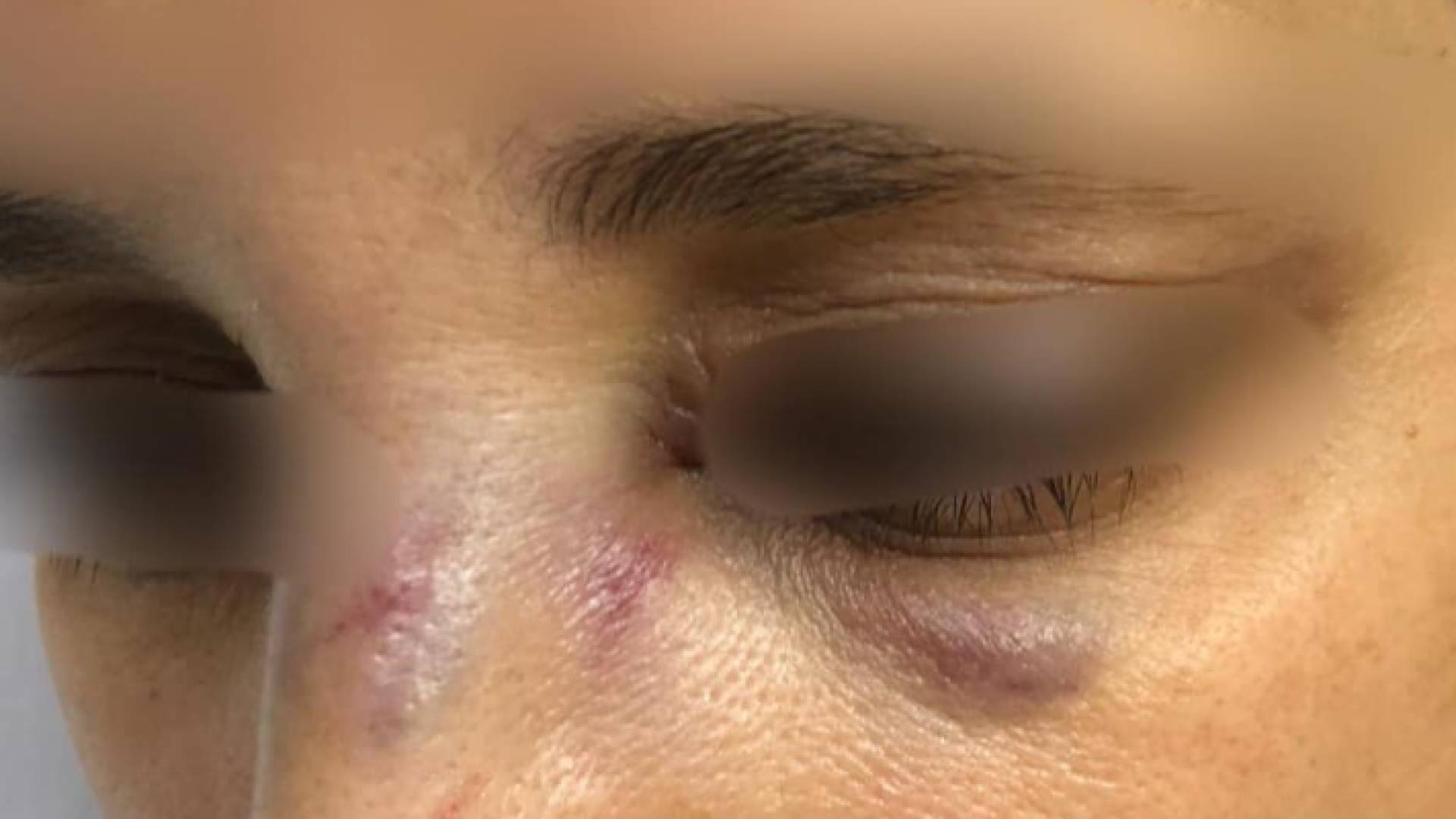 صورة الزوجة المعنفة من قبل زوجها كما نشرتها الناشطة