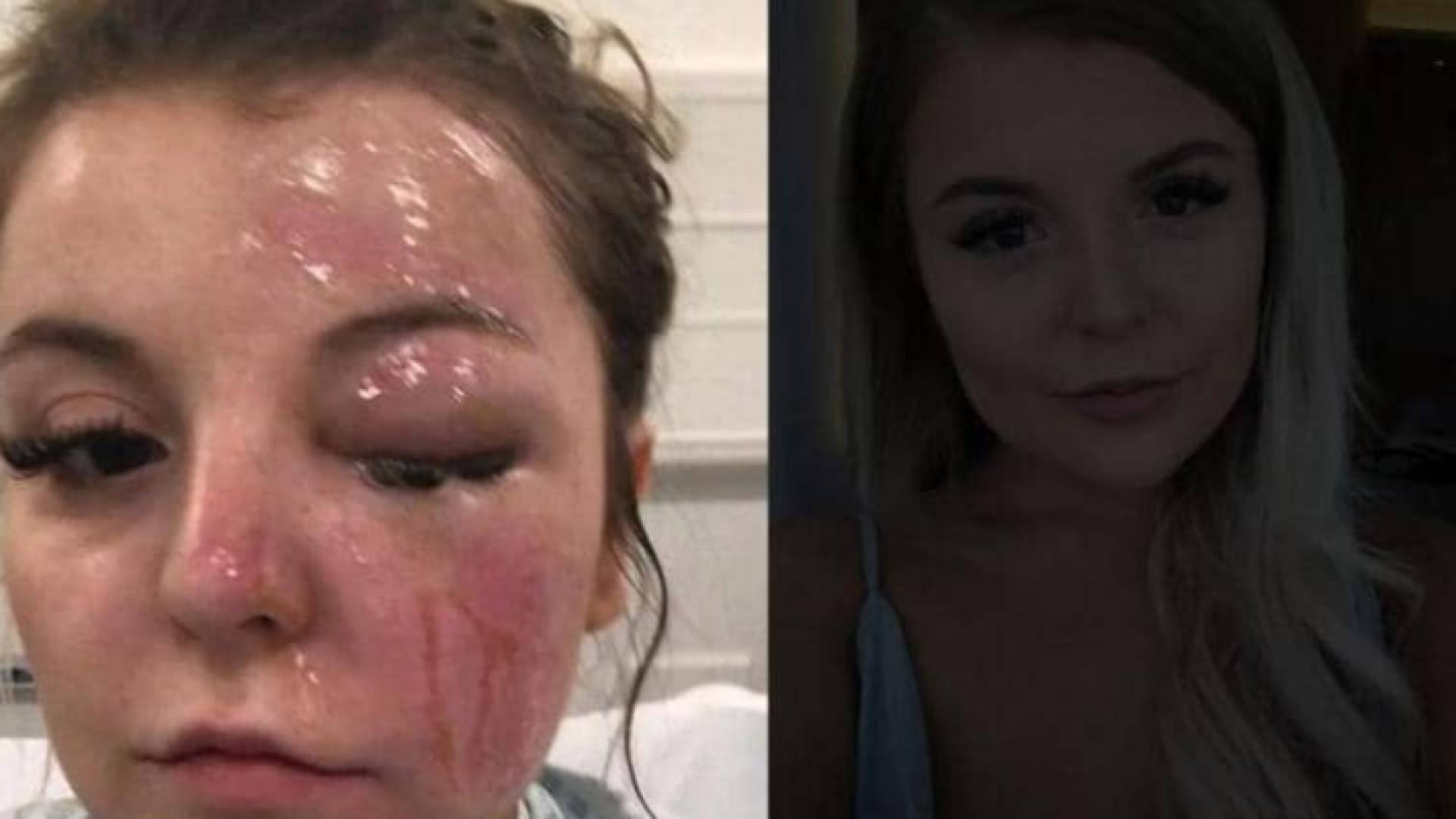 الفتاة البريطانية بيثاني روسر