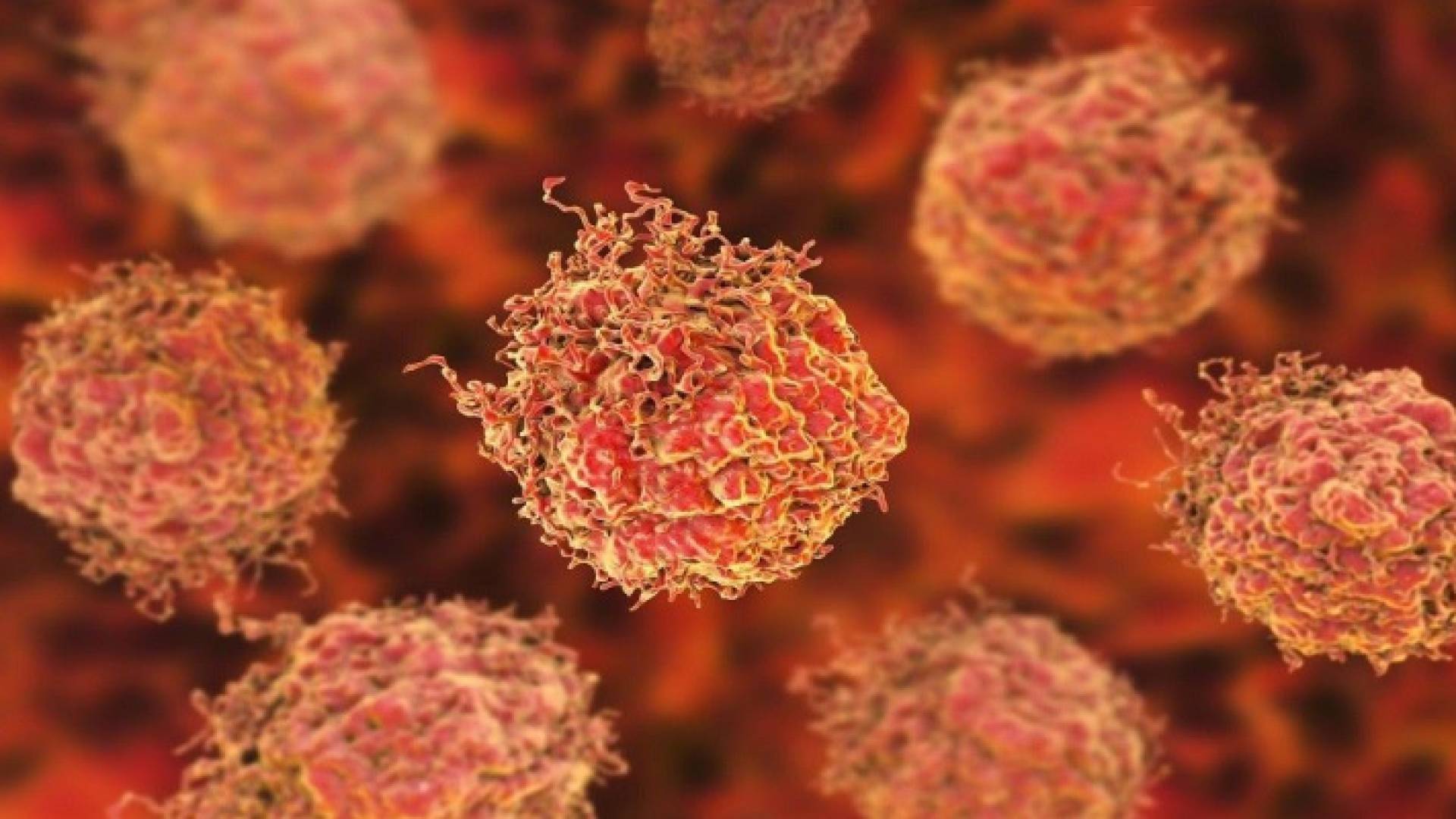 خلايا سرطانية - تعبيرية