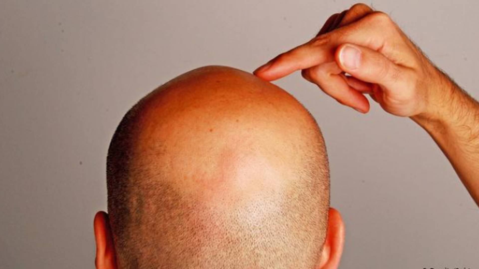 الصورة أرشيفية