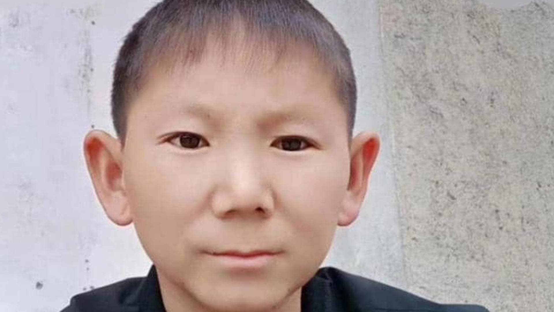 الشاب تعرض لإصابة في الرأس في صغره