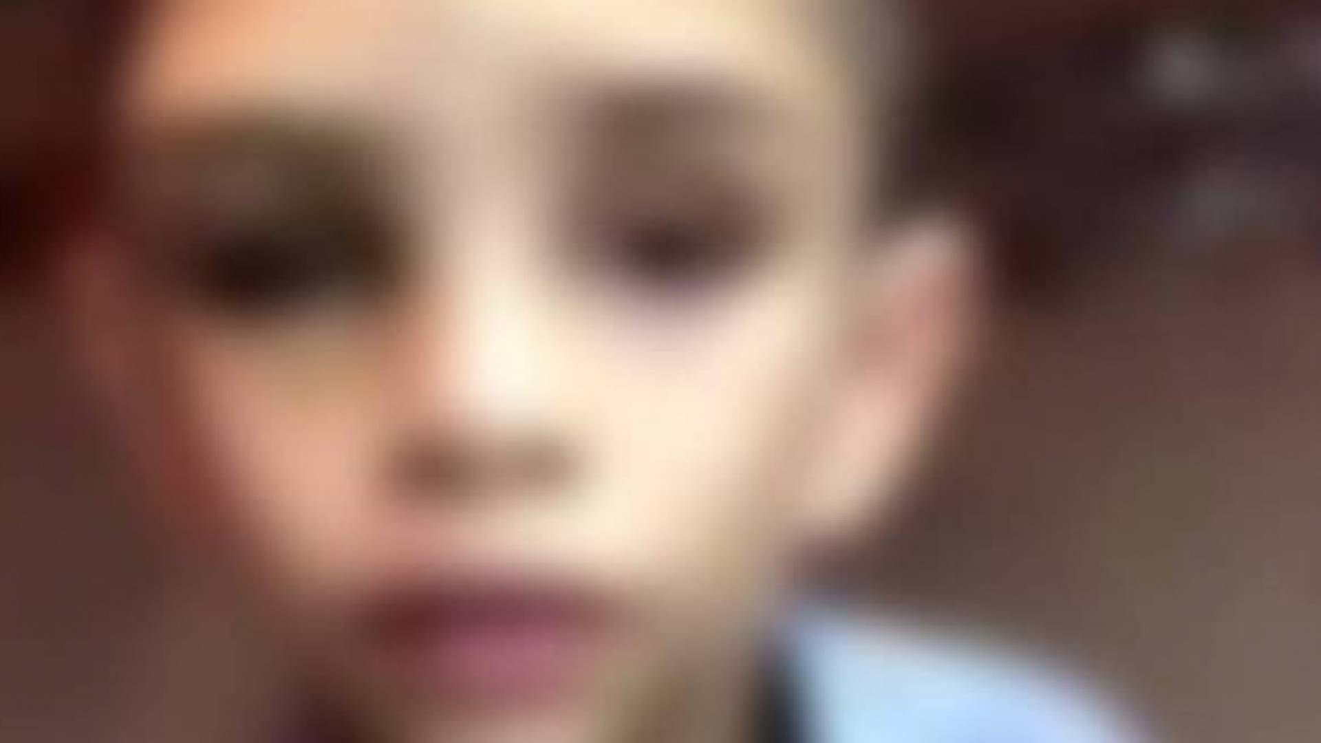 صورة الطفل السوري المعنف