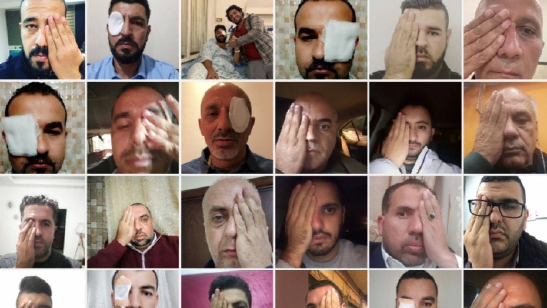 معاذ عمارنة لن يكون قادرا بعد اليوم على استكمال عمله الصحفي بسبب الاحتلال