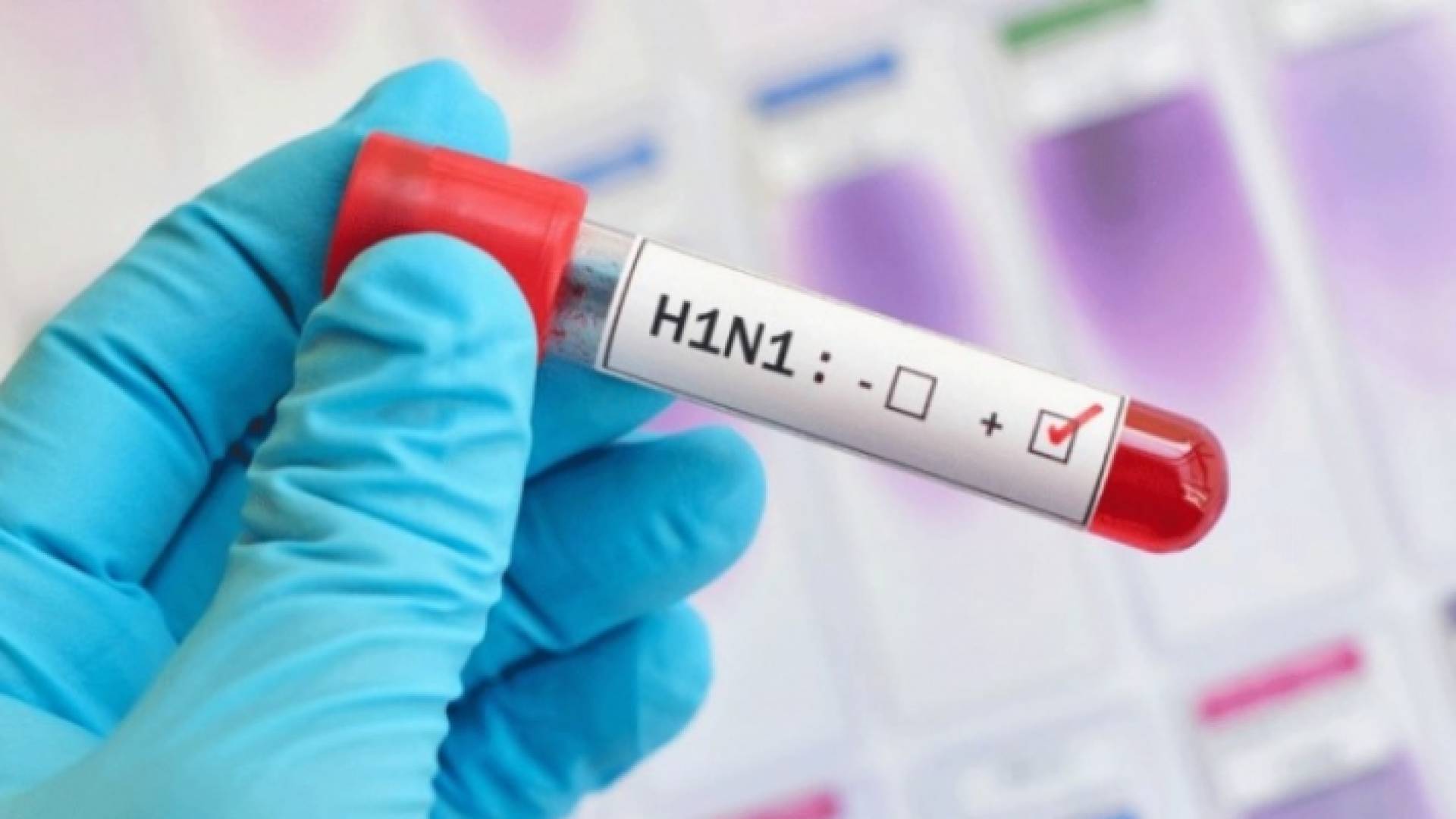 انفلونزا الخنازير