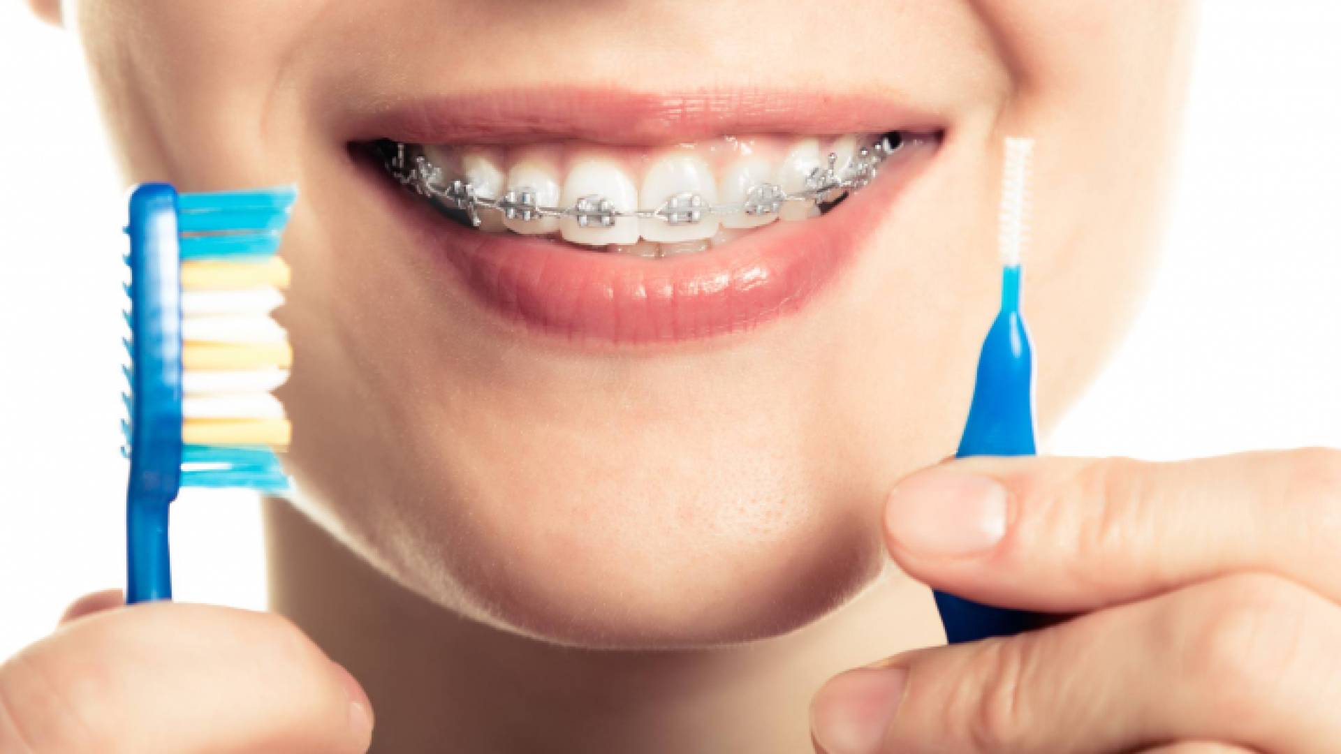 تنظيف الأسنان