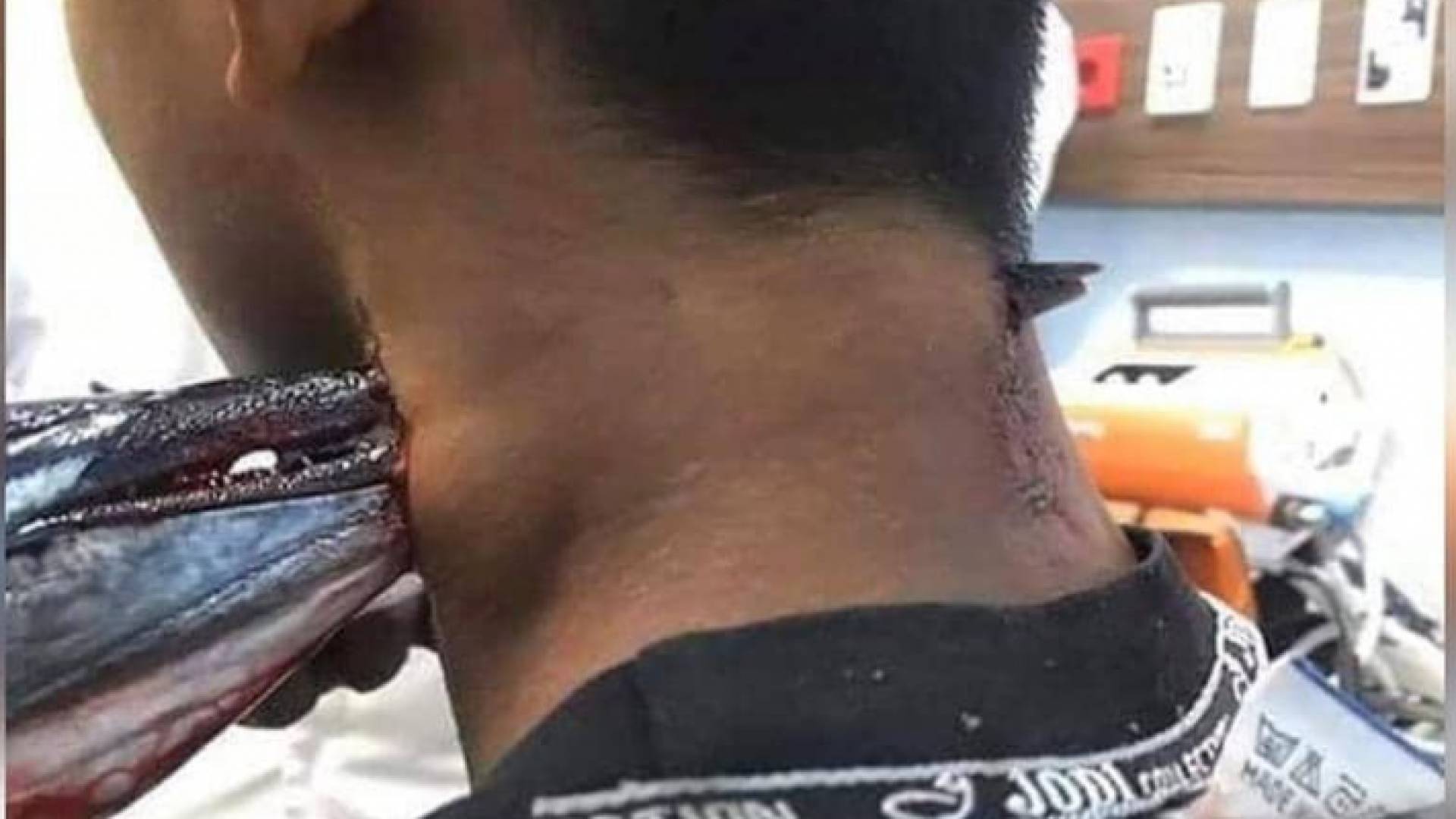 الشاب بقي على قيد الحياة