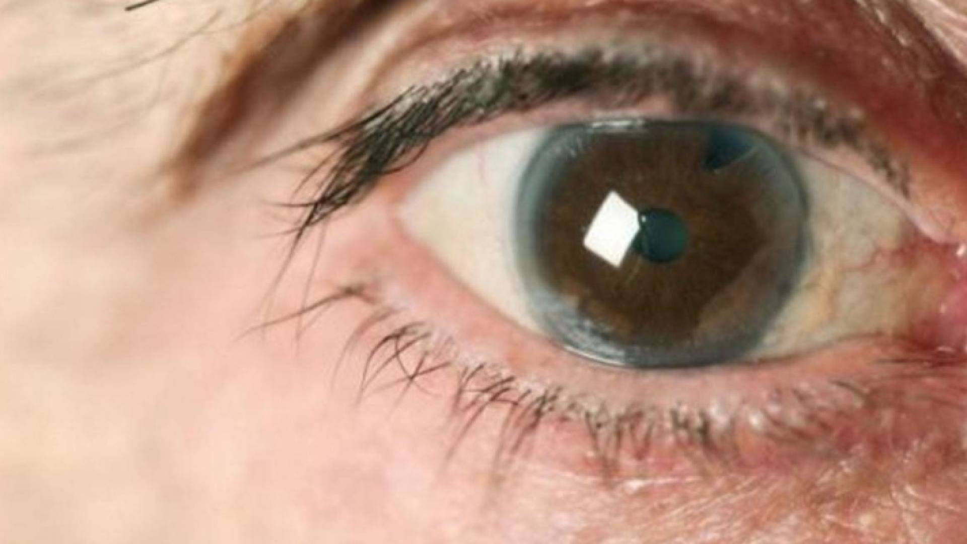 إصابة طبيب صيني مشهور بفيروس كورونا القاتل عبر العينين