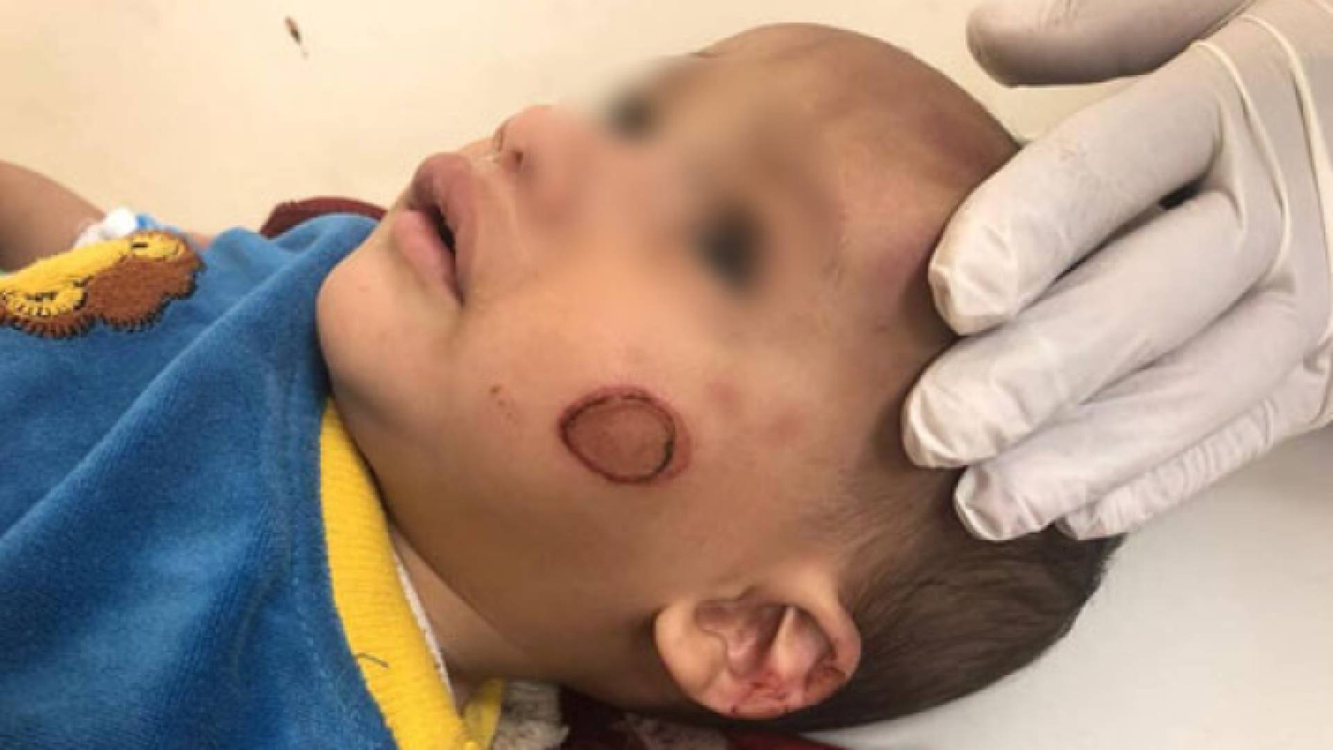 مصري يعذب رضيعا ويحرق جسده