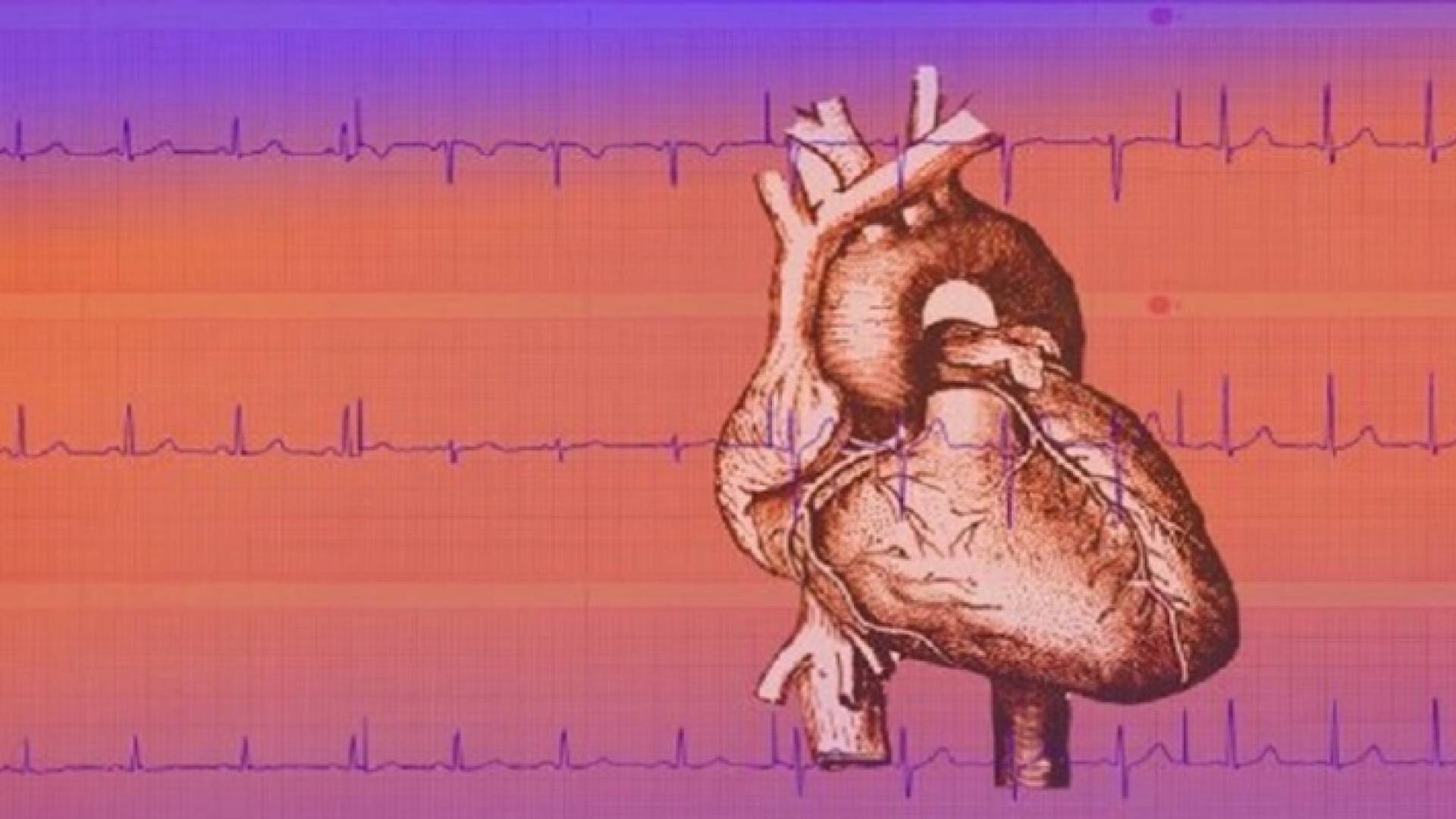 كيف نتعرف على النوبة القلبية قبل حدوثها بشهر