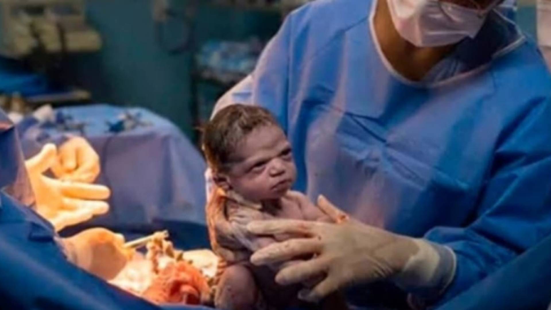 الطفلة ايزابيلا