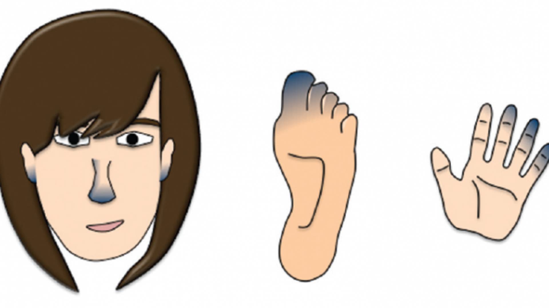 ظاهرة " رينو"