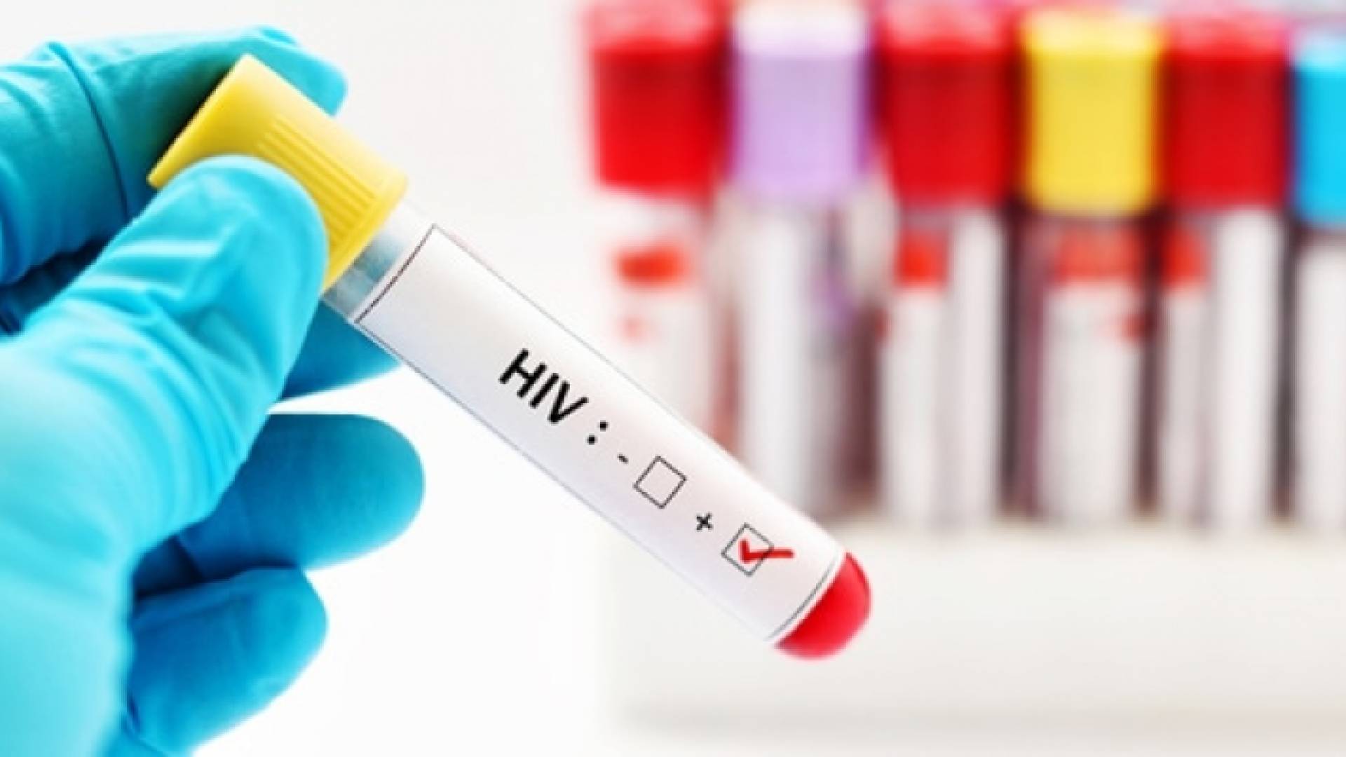 الزوجة اكتشفت إصابتها بالإيدز أثناء متابعتها للحمل.. أرشيفية