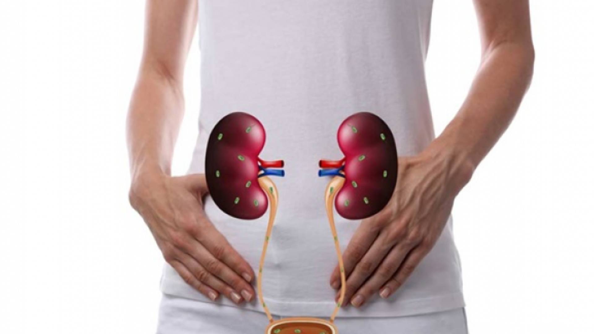 صورة تعبيرية