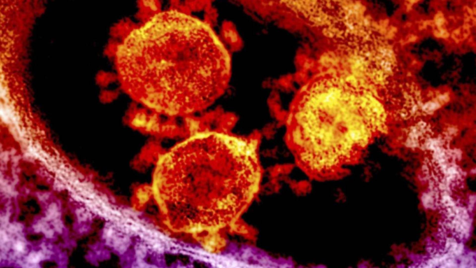 تتمثل الأعراض الأكثر شيوعا لمرض كوفيد-19 في الحمى والإرهاق والسعال الجاف