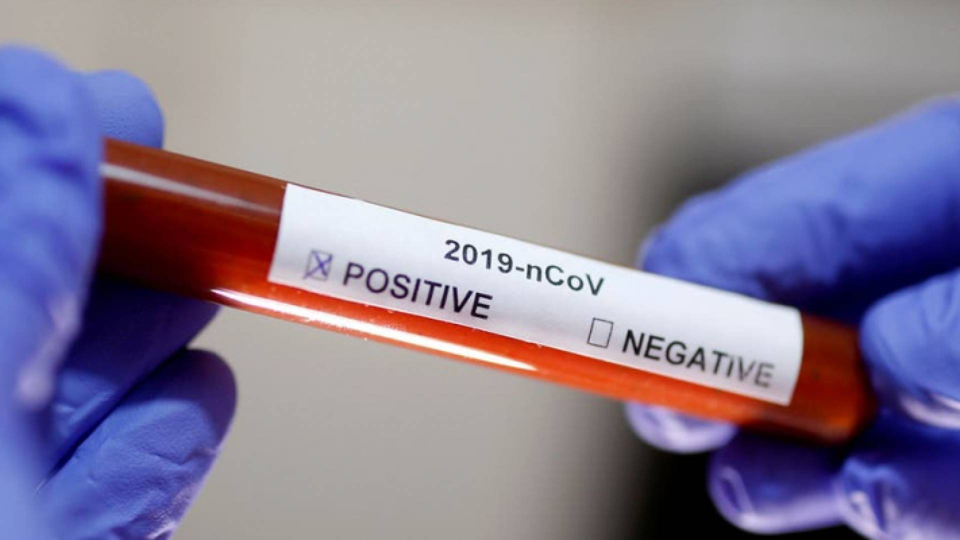 الصورة أرشيفية