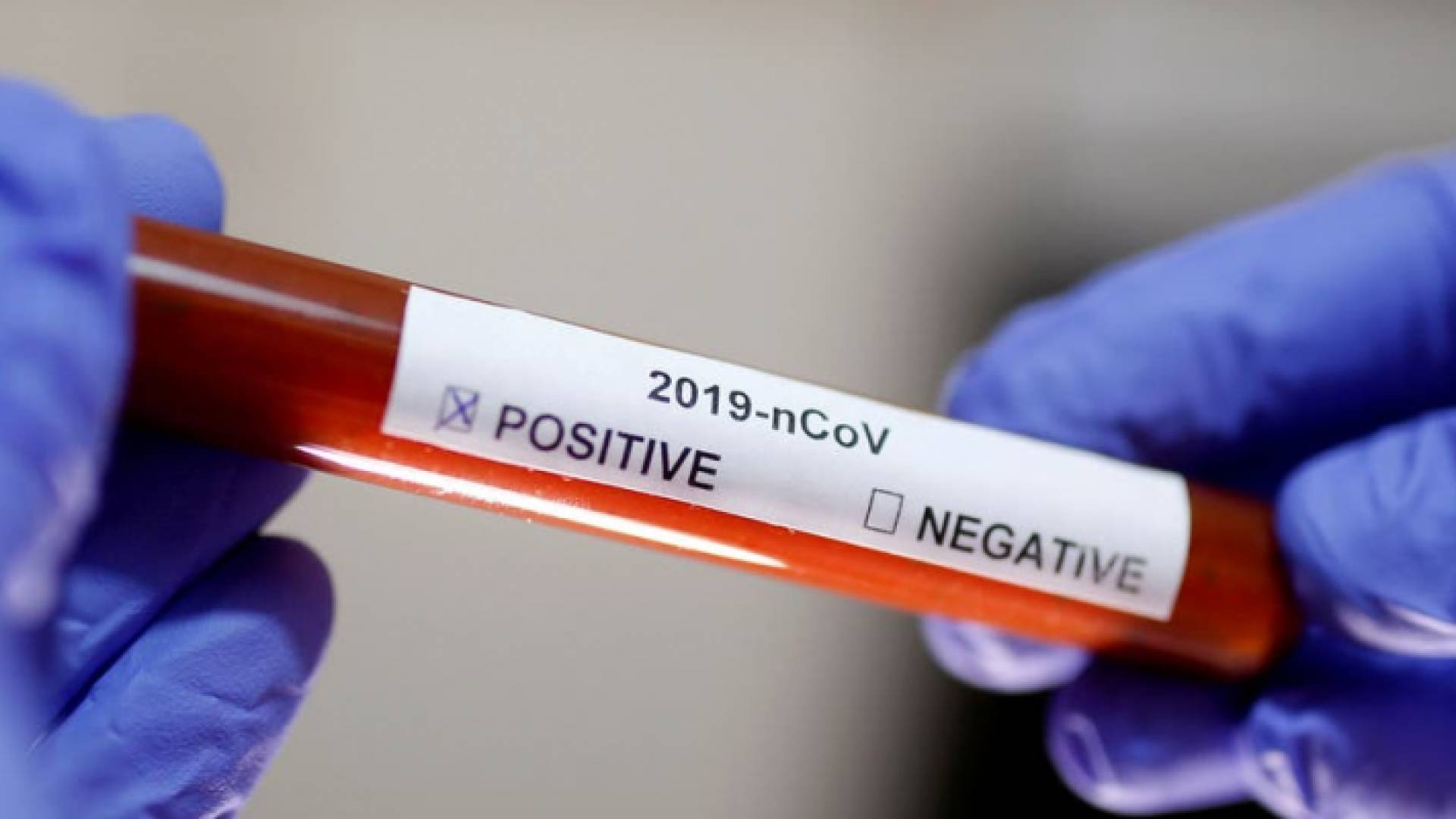 الصورة أرشيفية