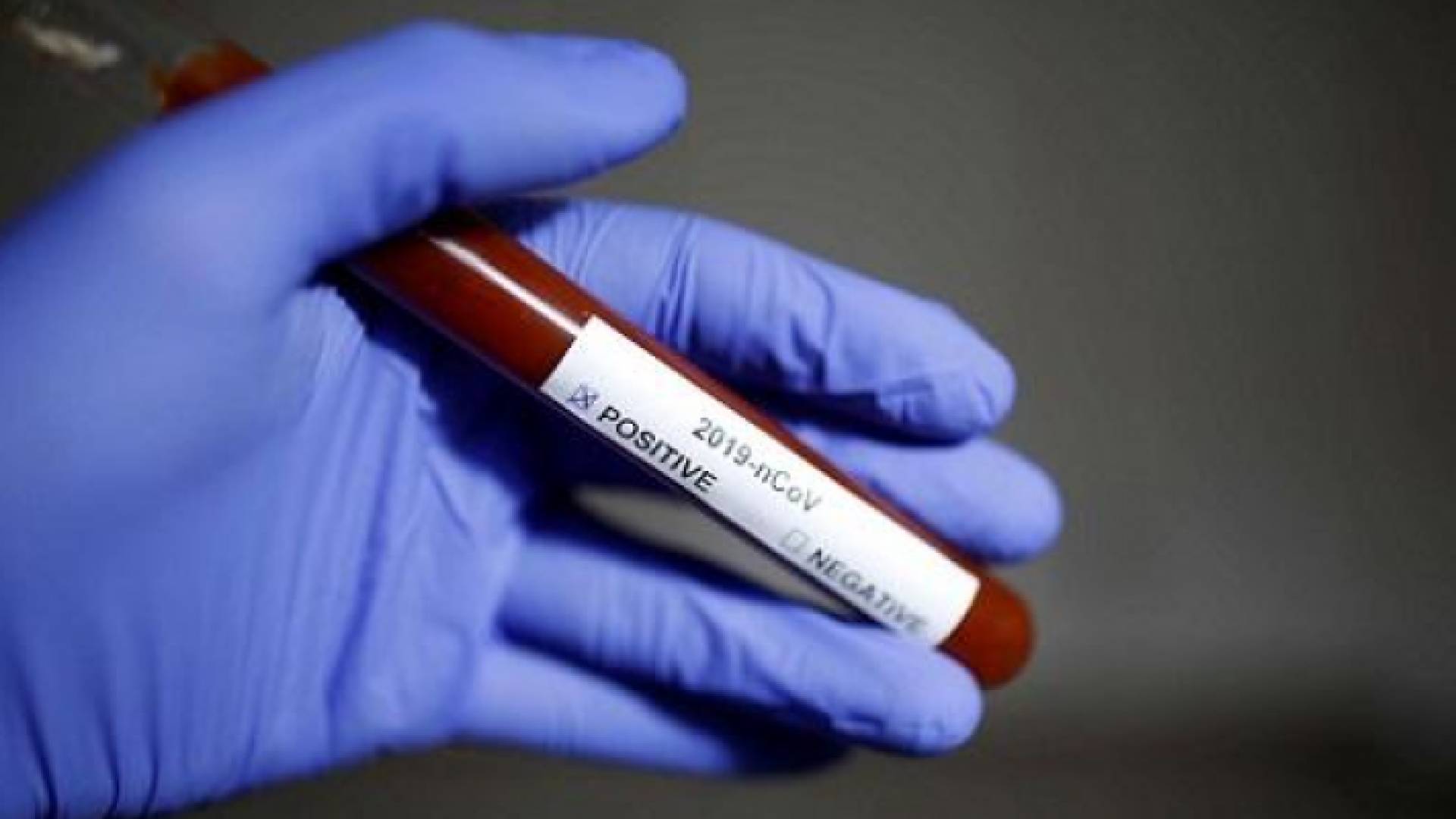 عينة كورونا