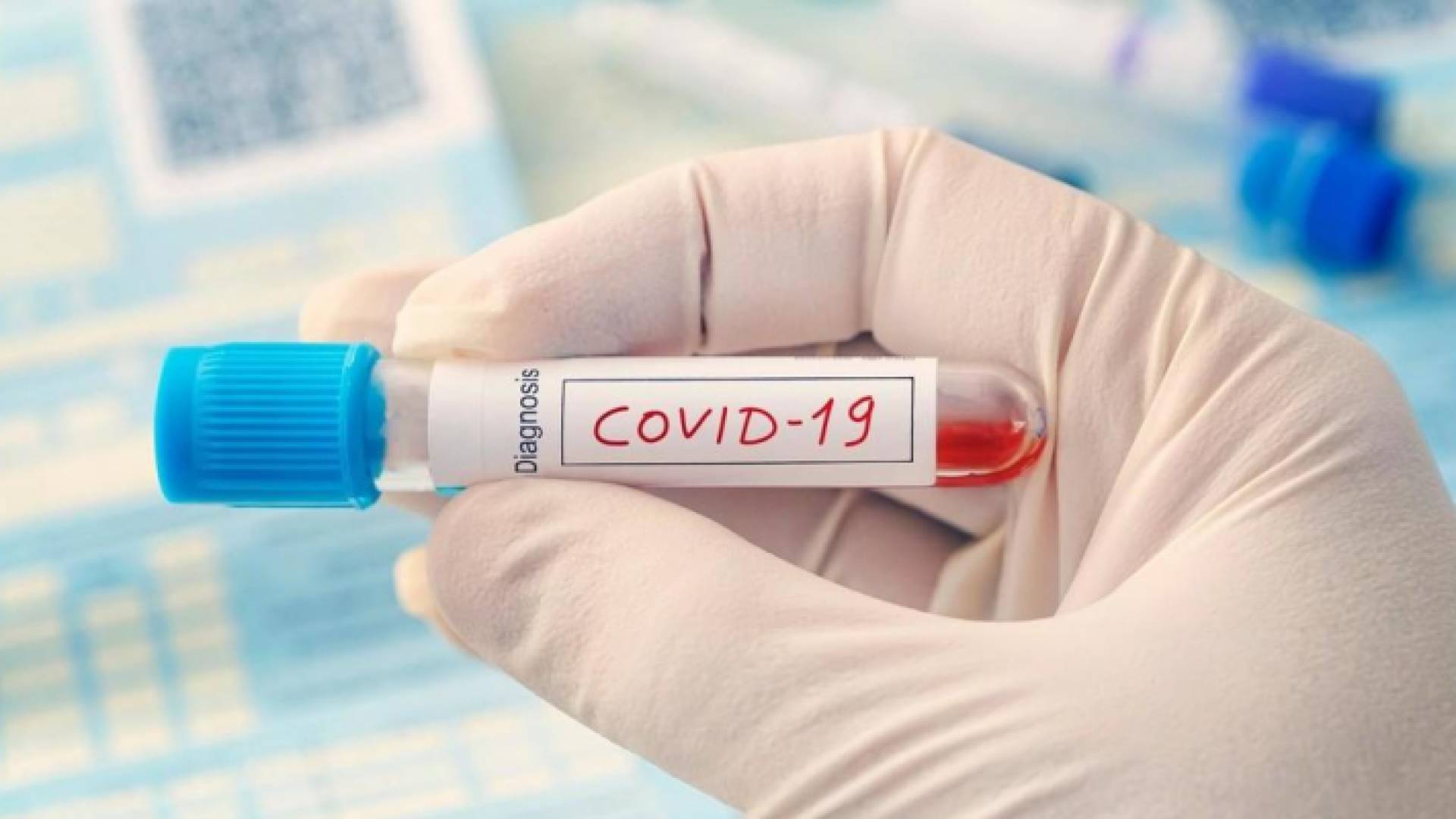 فحوصات كورونا