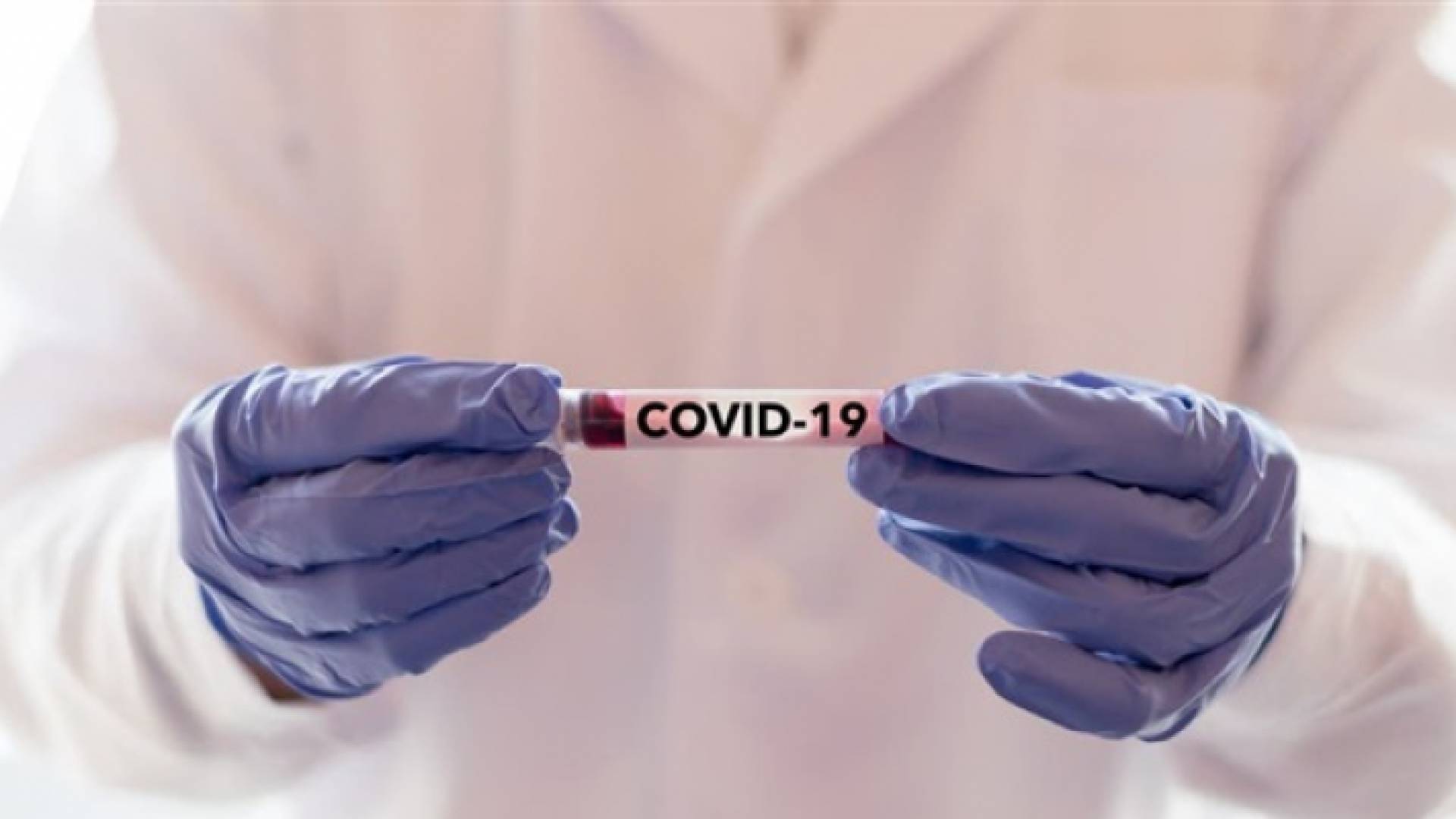 عينات فحص كورونا