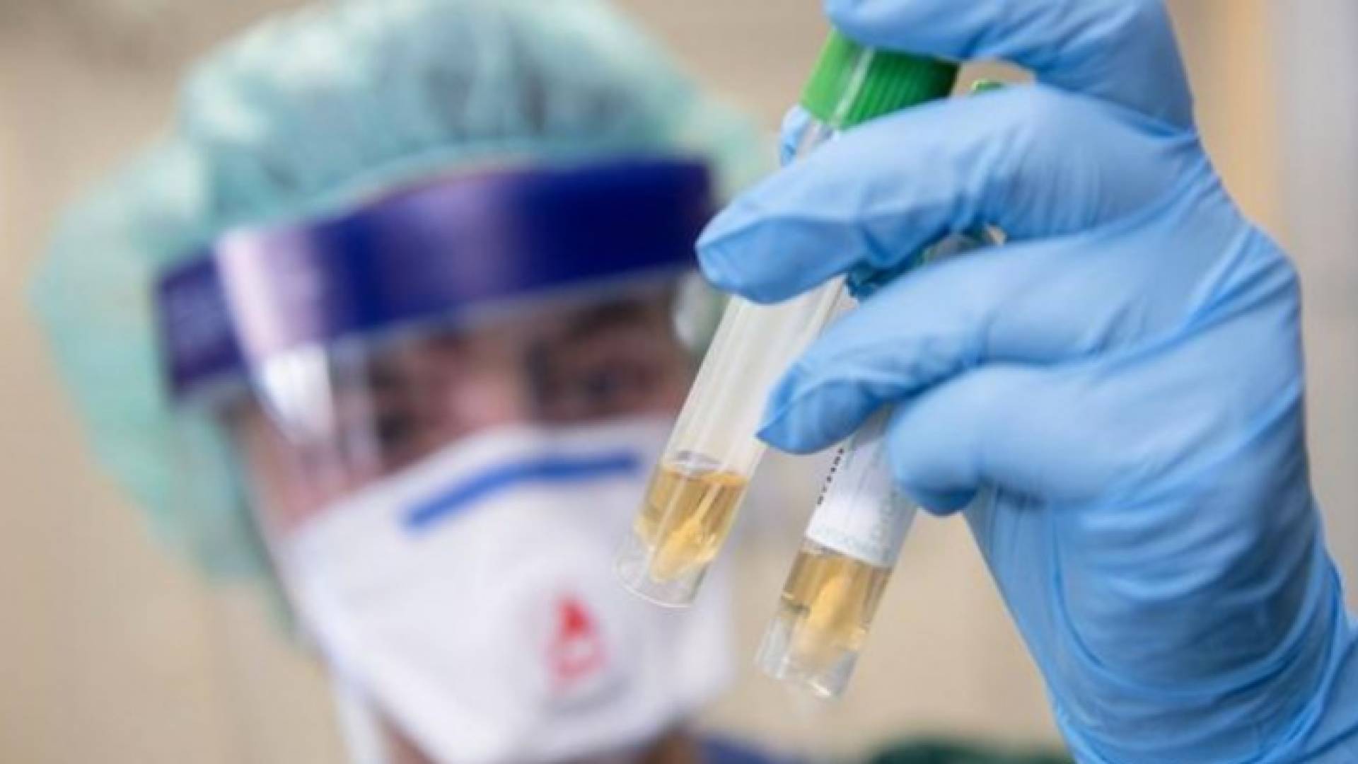 نتائج 192 عينة عشوائية في الطفيلة جاءت سلبية