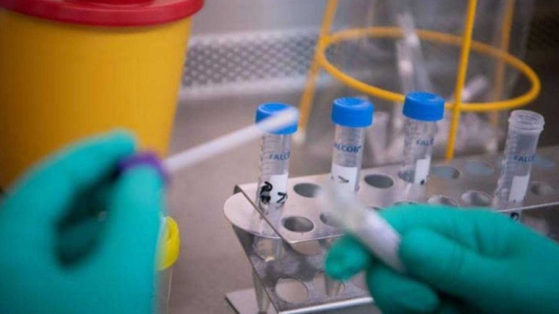 144 عينة عشوائية سلبية في الكرك