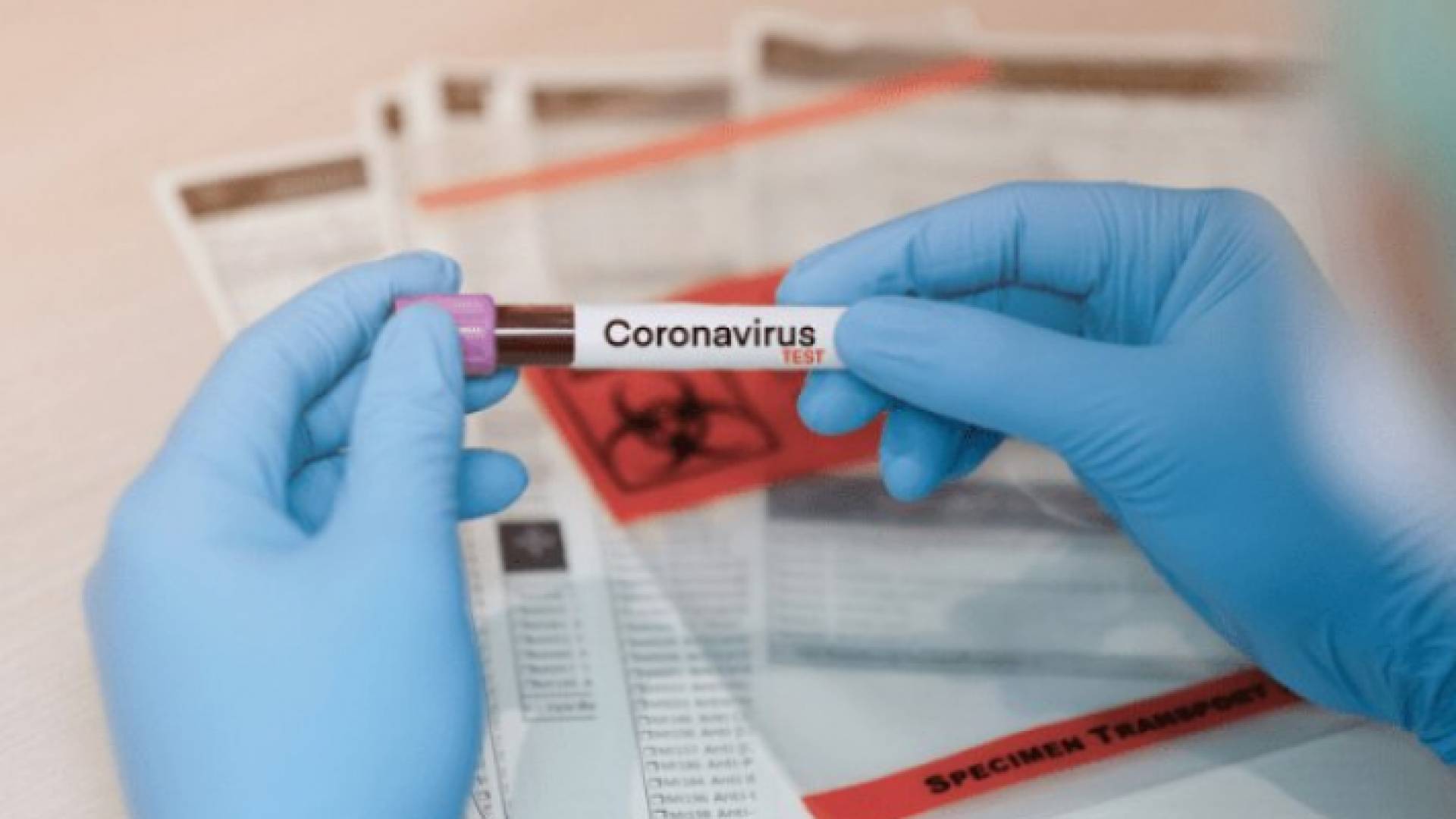 فرق التقصي الوبائي تنفذ سحب 33 عينة انفية