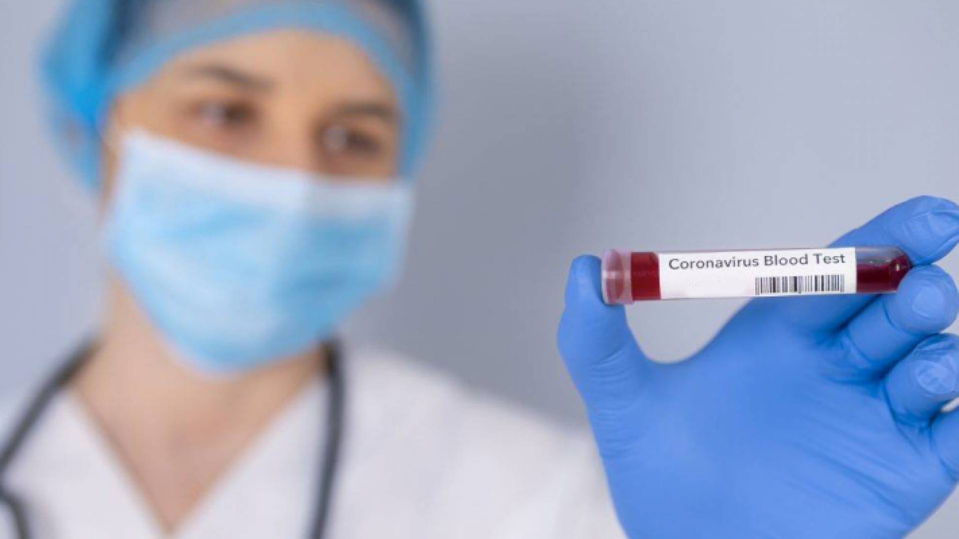 عينة فحص كورونا