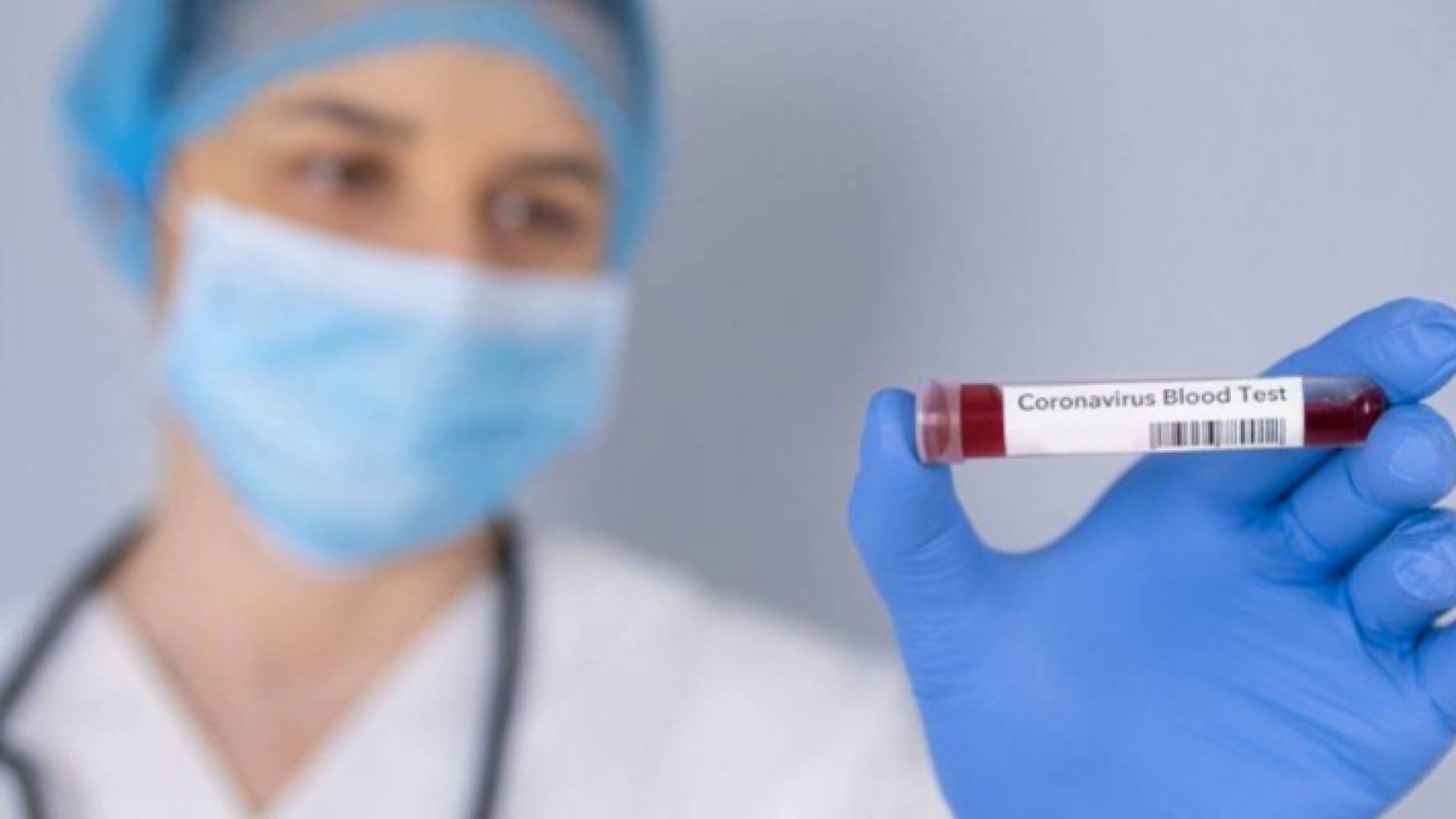 نتائج فحوصات نحو 100 عينة من مخالطين في الزرقاء سلبية