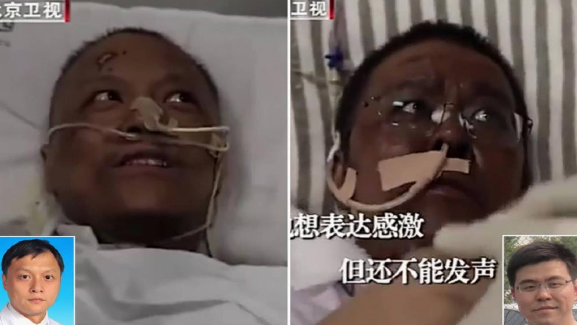 فيروس كورونا يغير لون جلد ناجيين