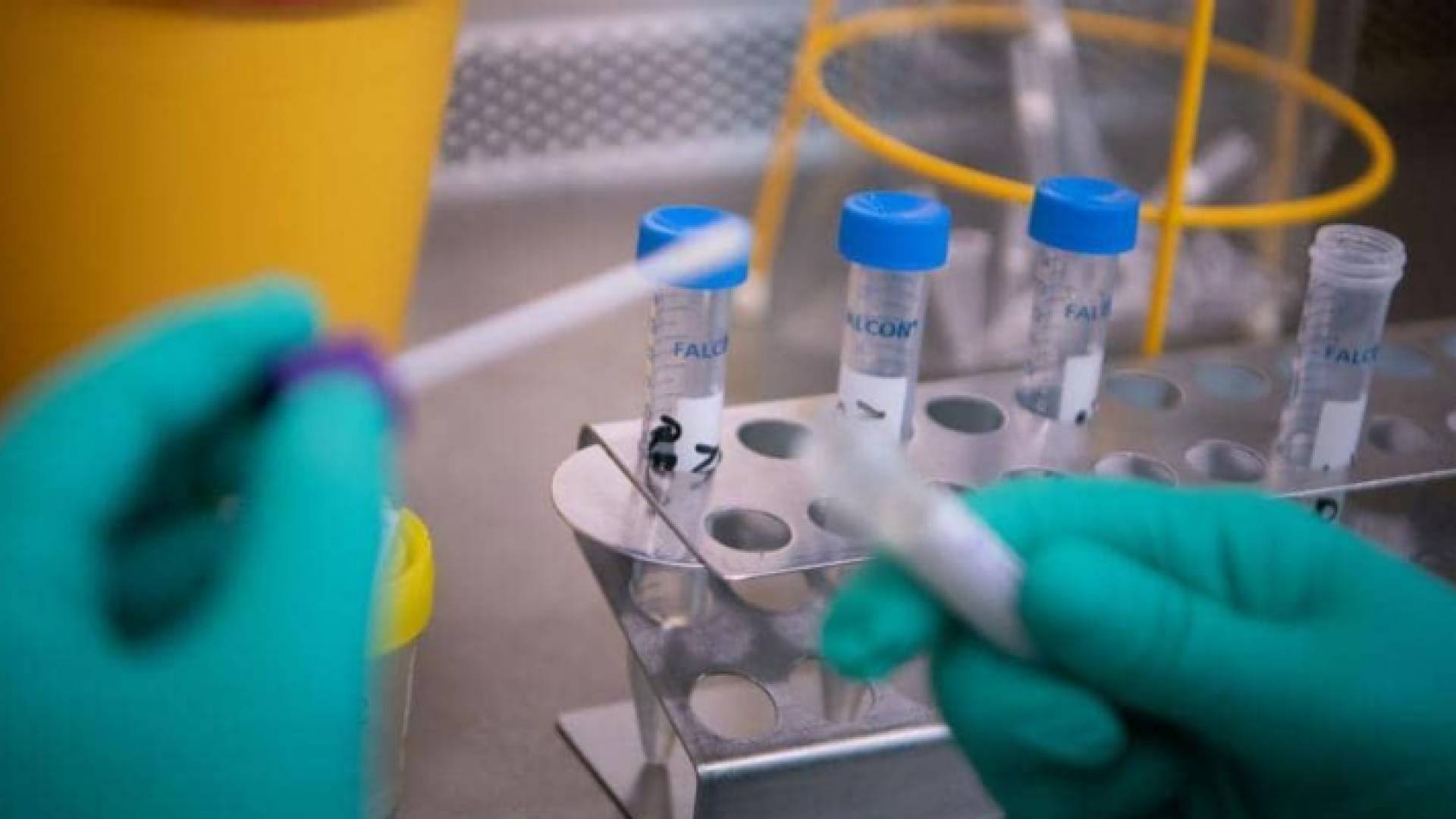 الصحة العالمية تكشف "المصدر المحتمل" لفيروس كورونا