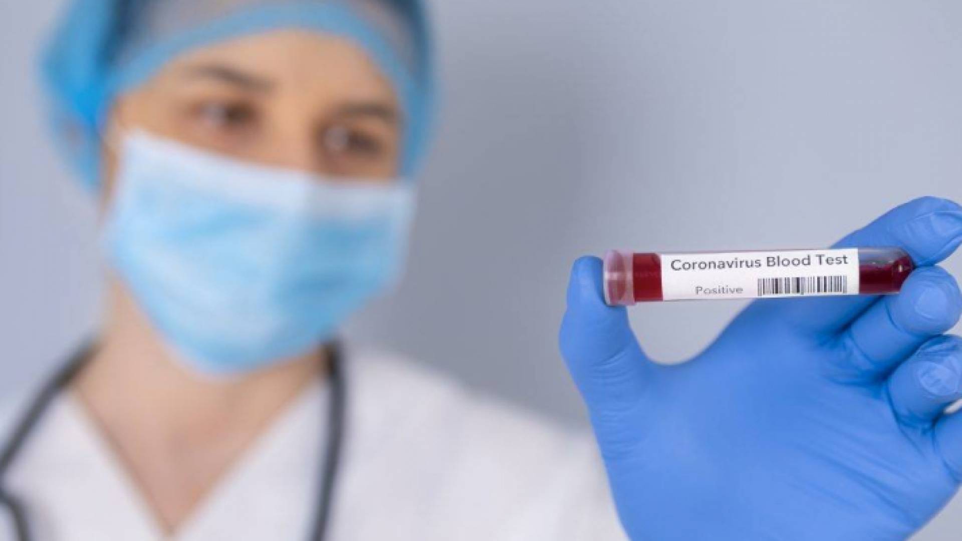 عينة فحص كورونا