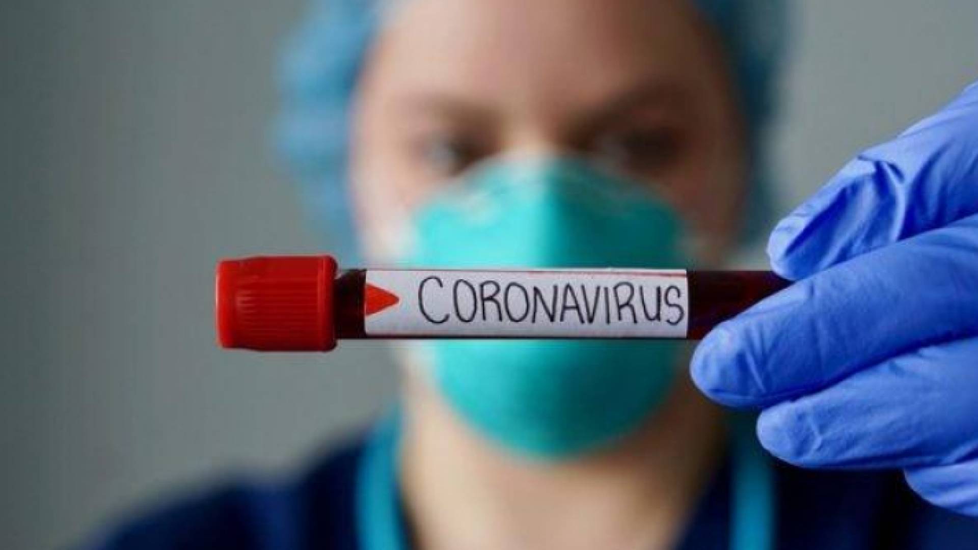 العالم يمر بحالة غير مسبوقة جراء كورونا