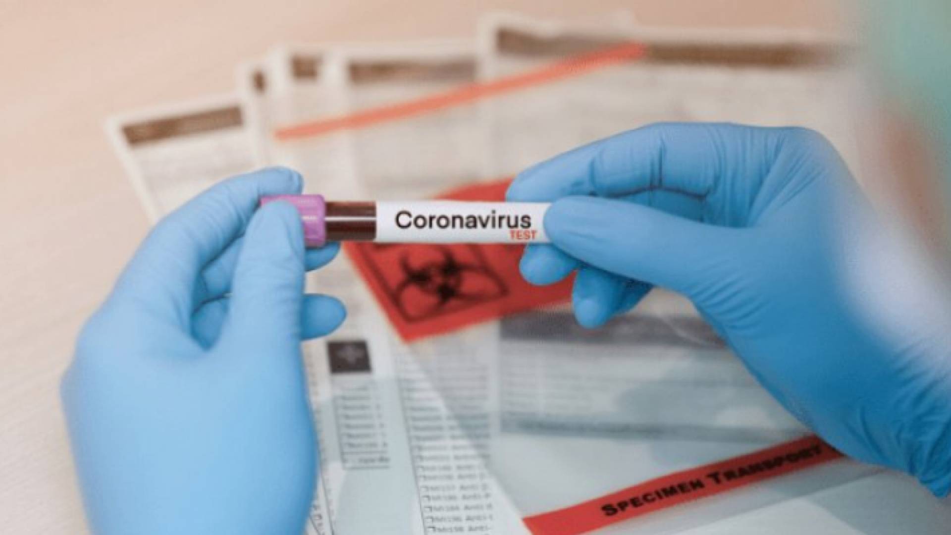 3 آلاف عينة كورونا تم فحصها في العقبة منذ بداية كورونا