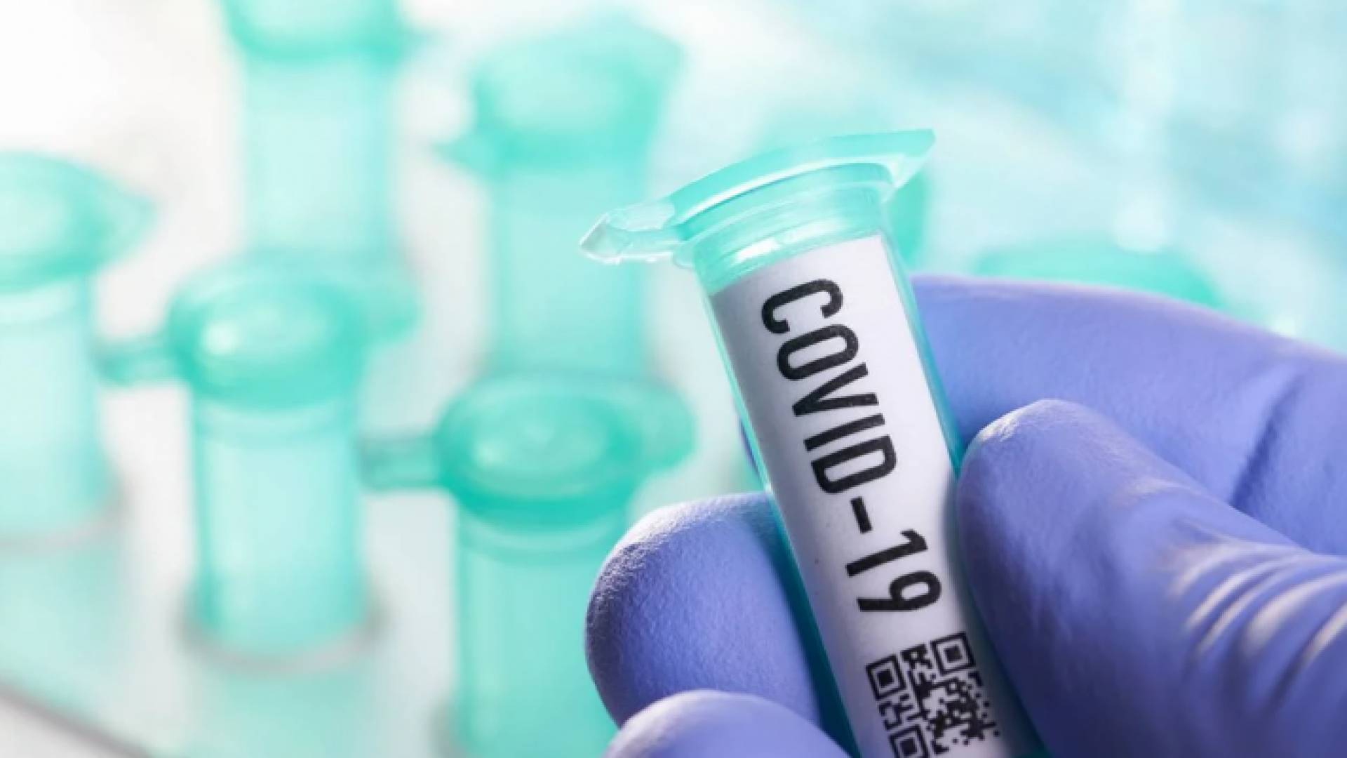 سحب 2700 عينة لفحص كورونا في بلدية الباسلية