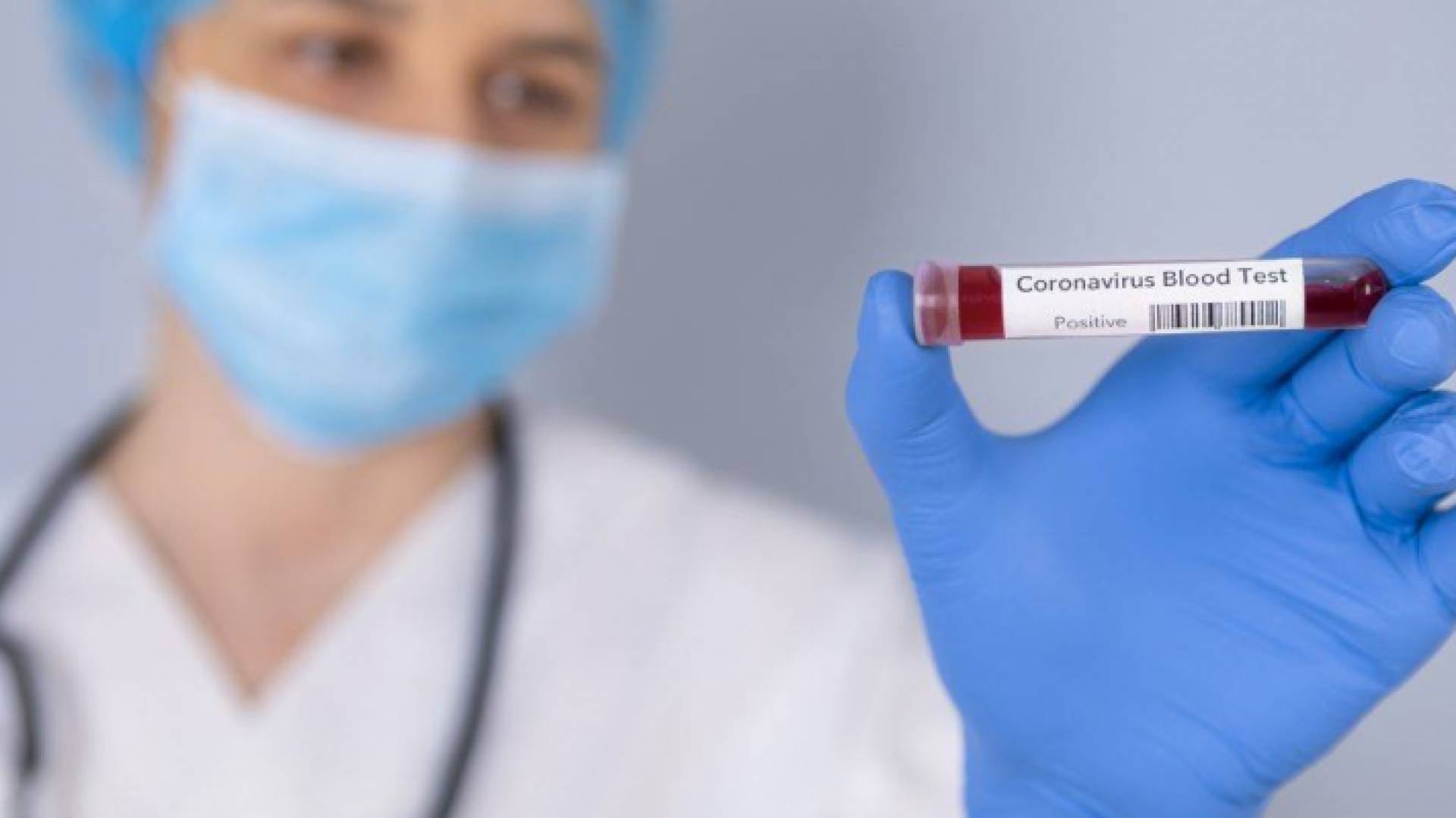 عينة فحص كورونا