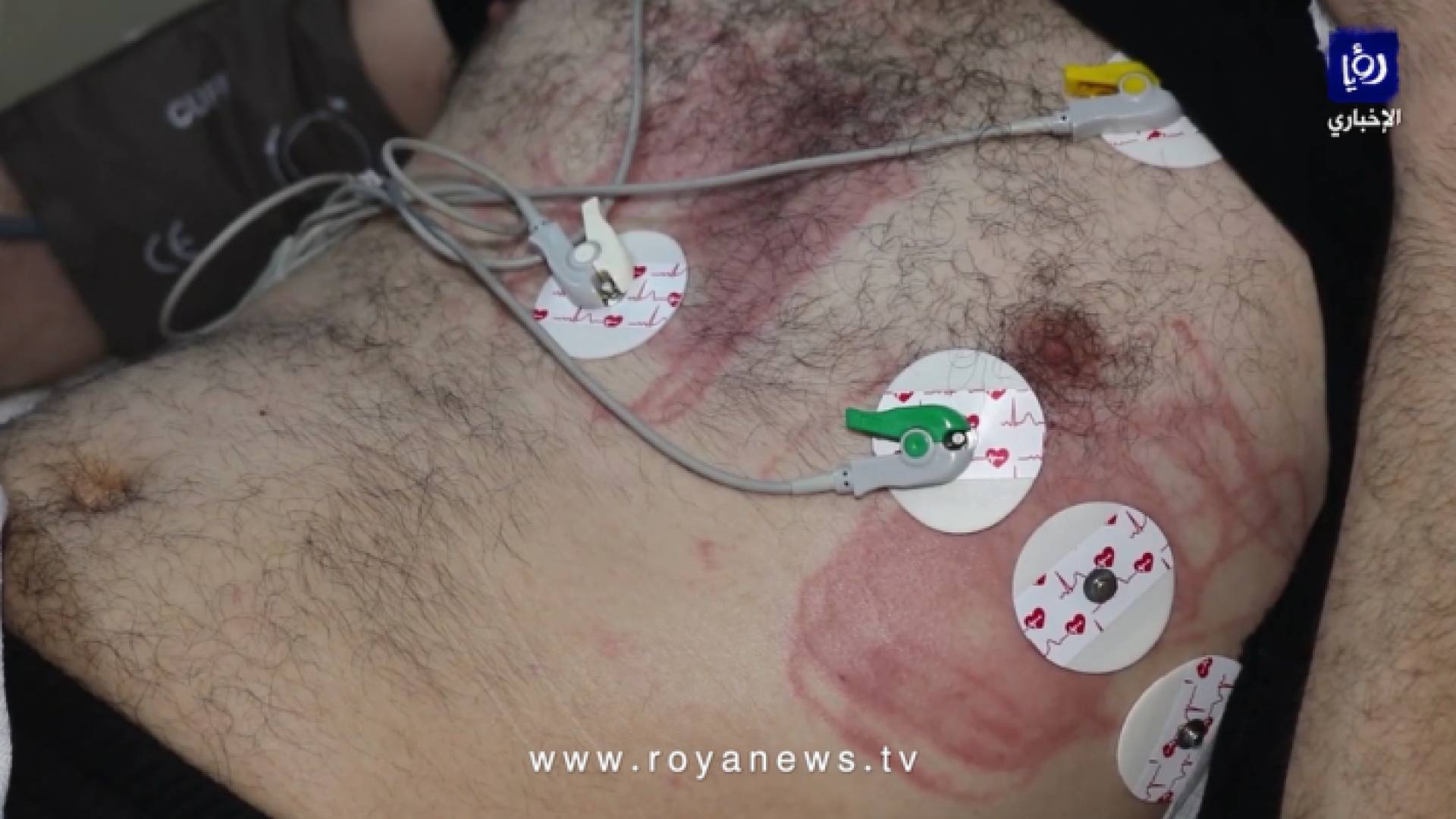 حسام ابو عيد العائد