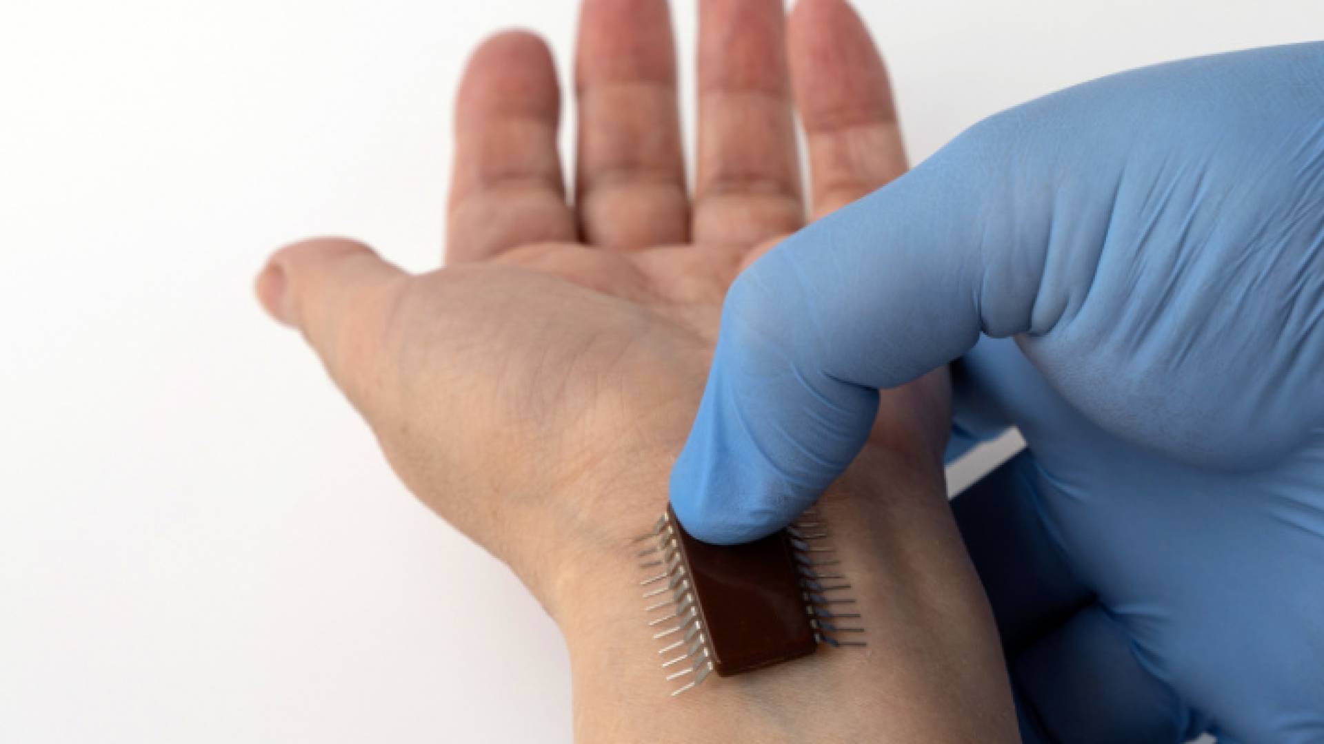 الصورة أرشيفية