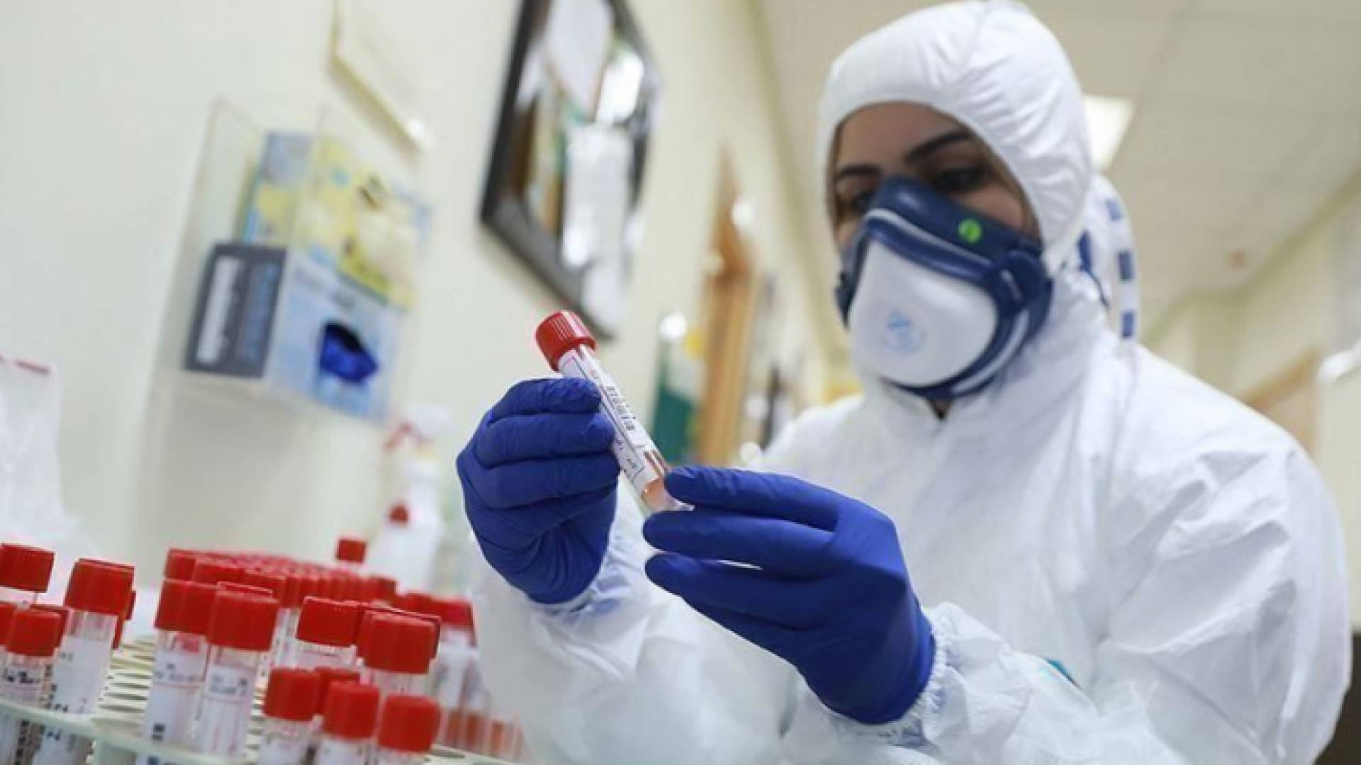 ارتفع عدد الاصابات في في الضفة إلى 651 اصابة