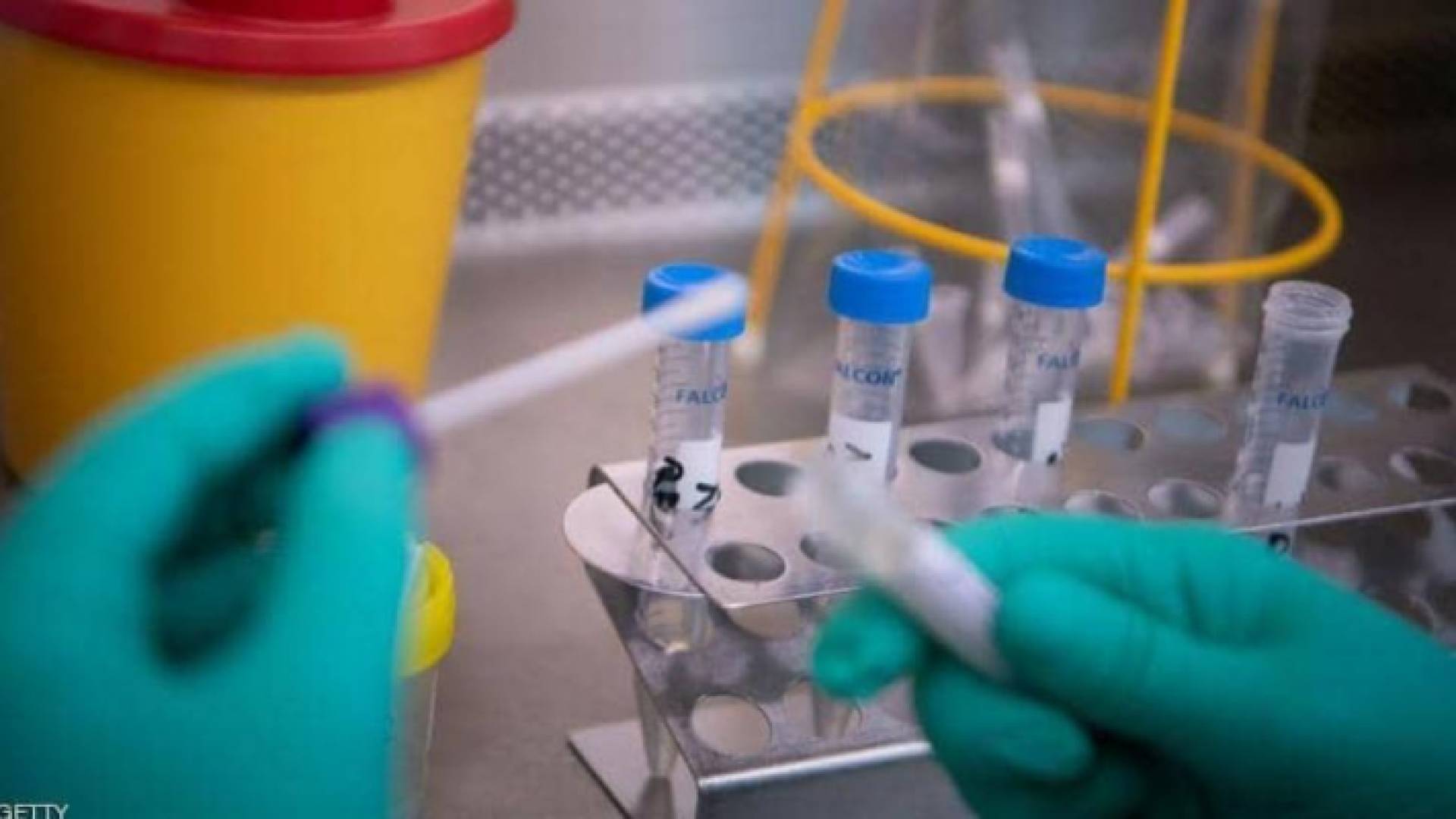 عينة فحص كورونا - ارشيفية